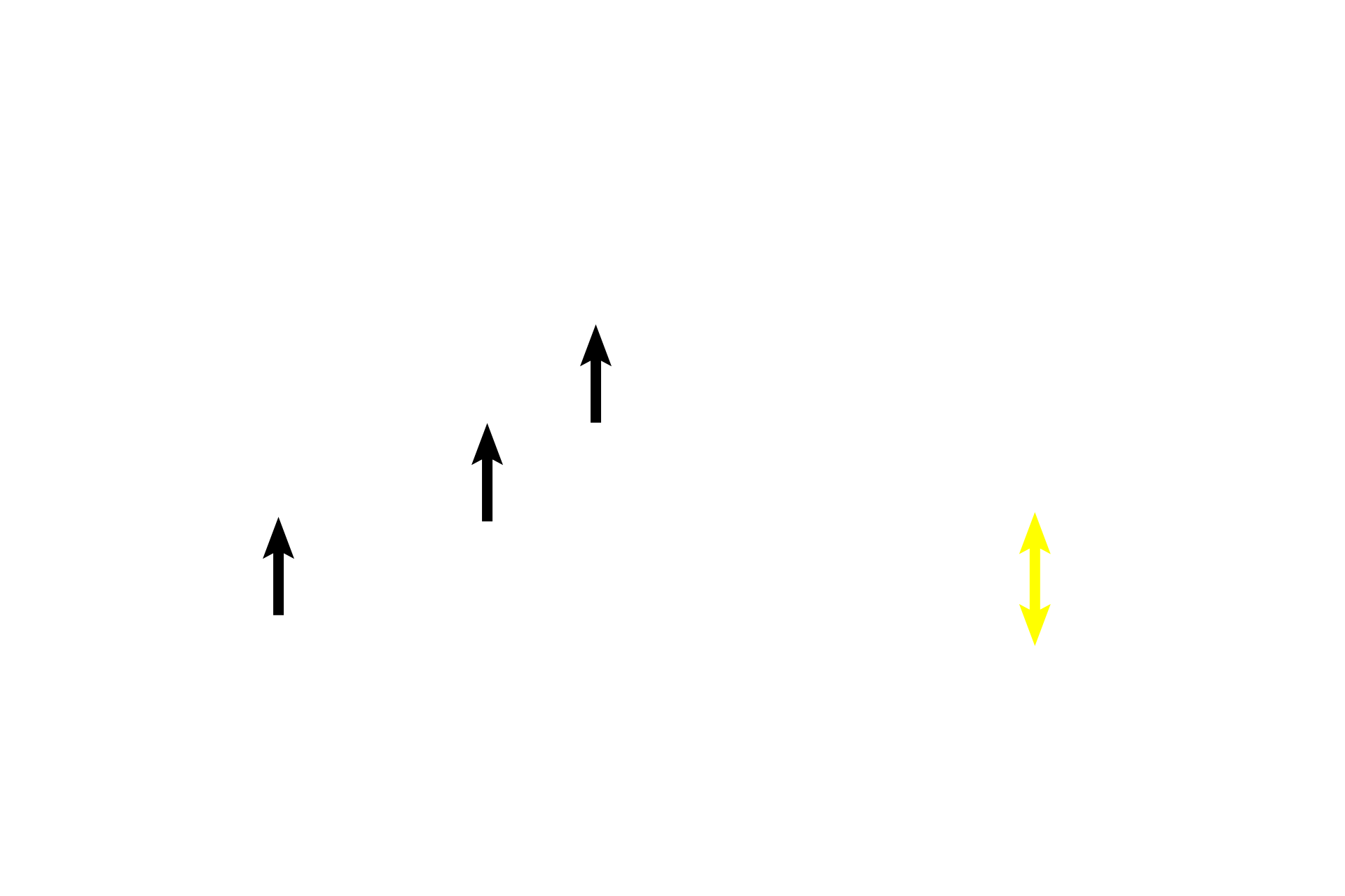  - Elastic lamina <p>In the left image, longitudinally oriented elastic fibers, typical for the respiratory system, are dispersed in the lamina propria.</p>
