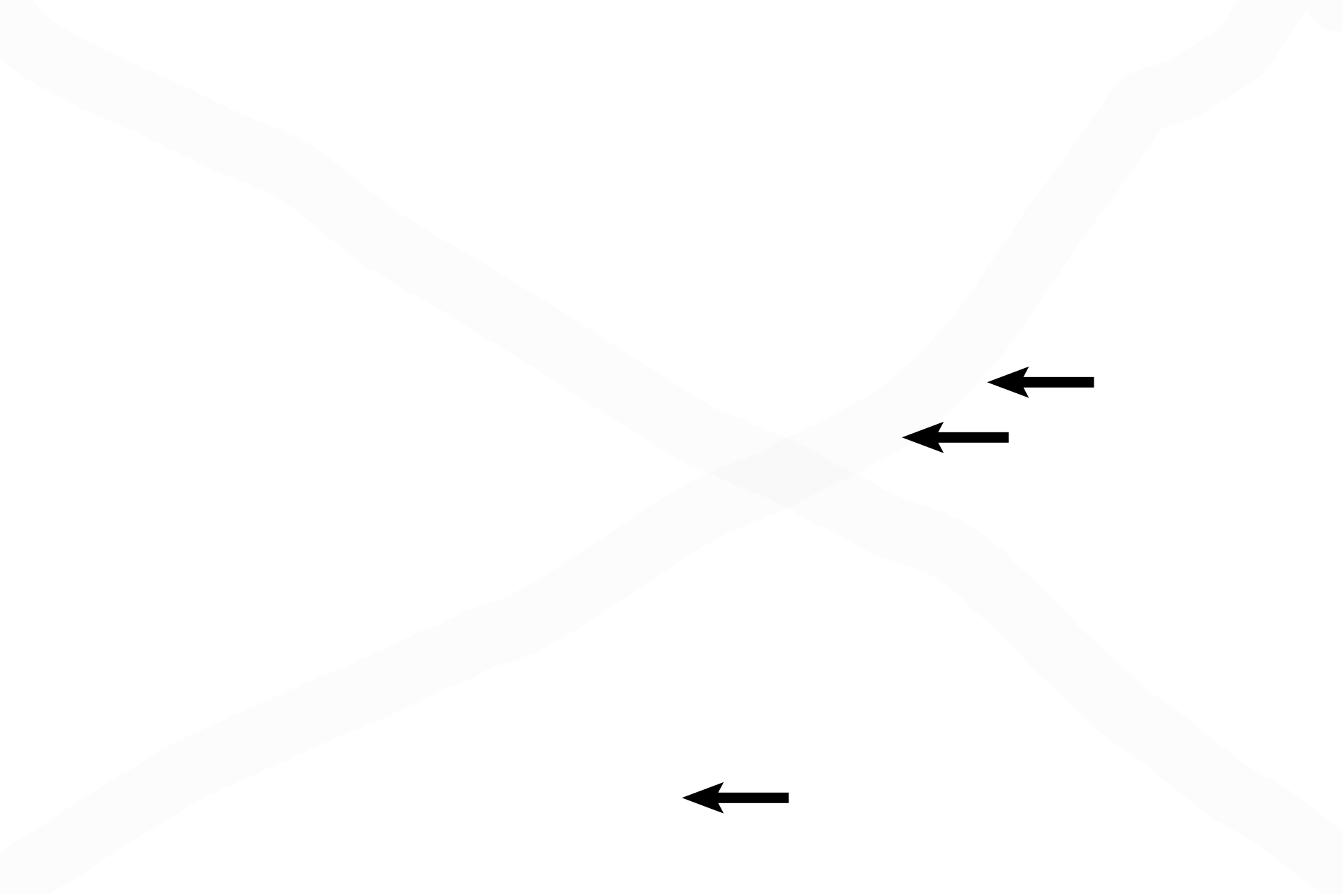  - Type II cells > <p>Septal cells (type II alveolar cells) form the remainder of the alveolar lining. These cells, the source of surfactant, are spherical, frothy, and bulge into the alveolar spaces. </p>
