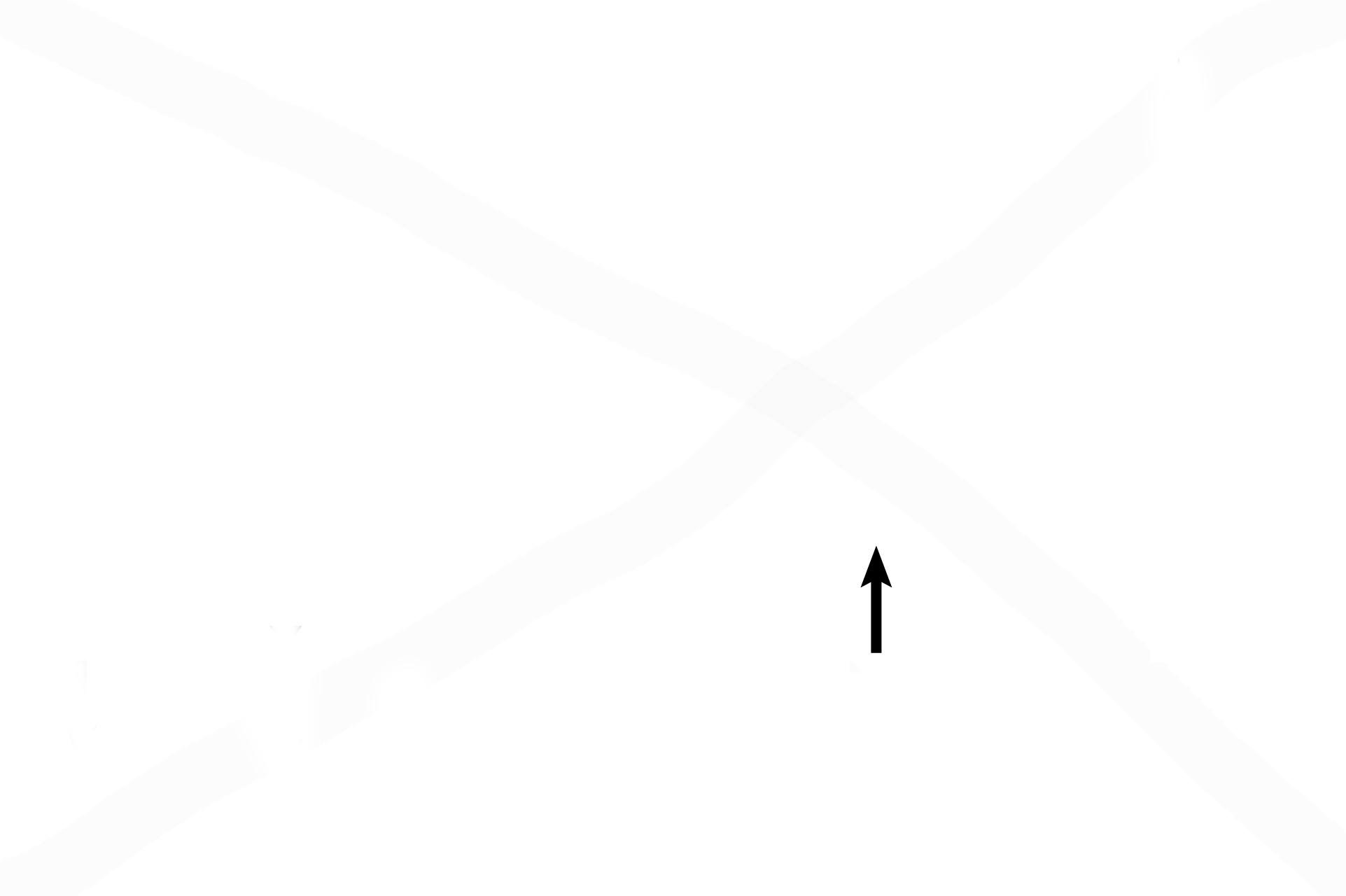 Macrophage > <p>Macrophages are present within the interalveolar septum or lying free in the surfactant layer of the alveolus. When filled with particulate matter such as carbon that has escaped the cleansing mechanisms of higher passageways, macrophages, like the one seen here, are known as dust cells. </p>
