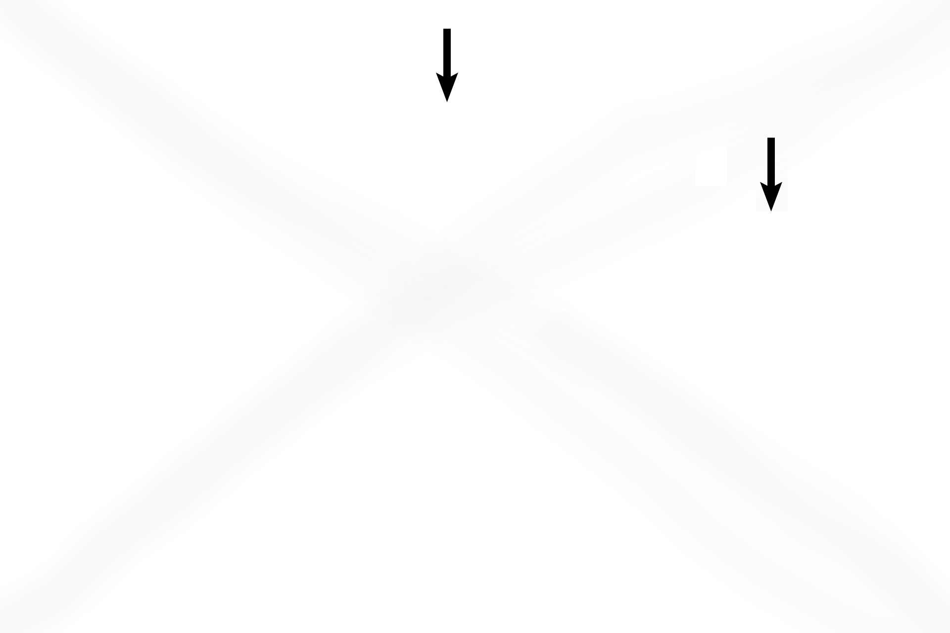 CT and smooth muscle <p>Alveolar ducts are formed by knobs lined by simple cuboidal epithelium, without cilia or club cells. The epithelium overlies very thin layers of connective tissue and strands of smooth muscle. The (inter)alveolar septum separating individual alveoli possesses a capillary bed where gas exchange occurs. 400x</p>
