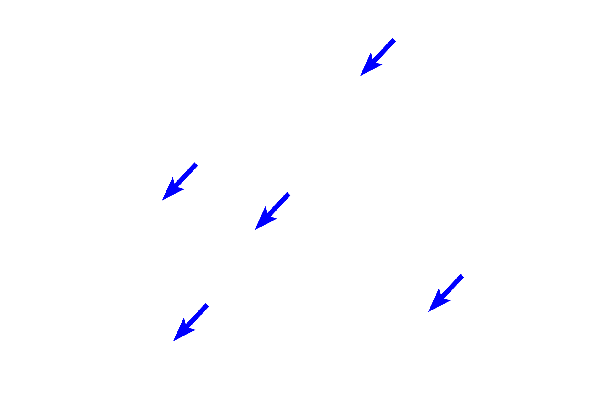 Collagen fibers (xs) <p>This tissue is characterized by thick, interlacing collagen fibers and bundles, with reduced intervening gelatinous ground substance. Fibers are seen sectioned longitudinally (ls) and transversly (xs). The majority of cells are fibroblasts. All connective tissue proper possesses elastic fibers, however, they are difficult to distinguish from collagen with this hematoxylin and eosin stain. 400x</p>
