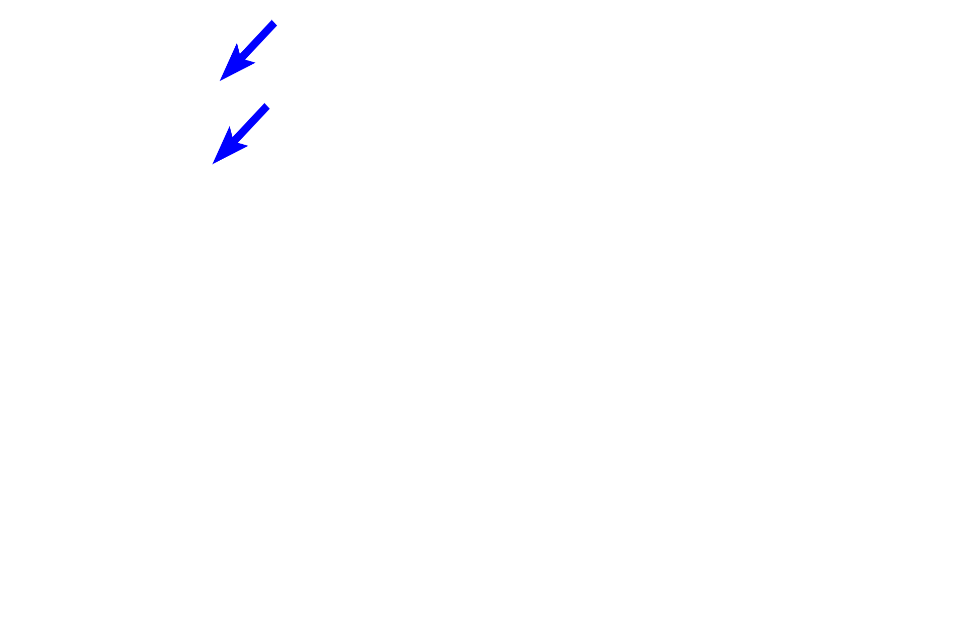 Blood vessels <p>This tissue is characterized by thick, interlacing collagen fibers and bundles, with reduced intervening gelatinous ground substance. Fibers are seen sectioned longitudinally (ls) and transversly (xs). The majority of cells are fibroblasts. All connective tissue proper possesses elastic fibers, however, they are difficult to distinguish from collagen with this hematoxylin and eosin stain. 400x</p>
