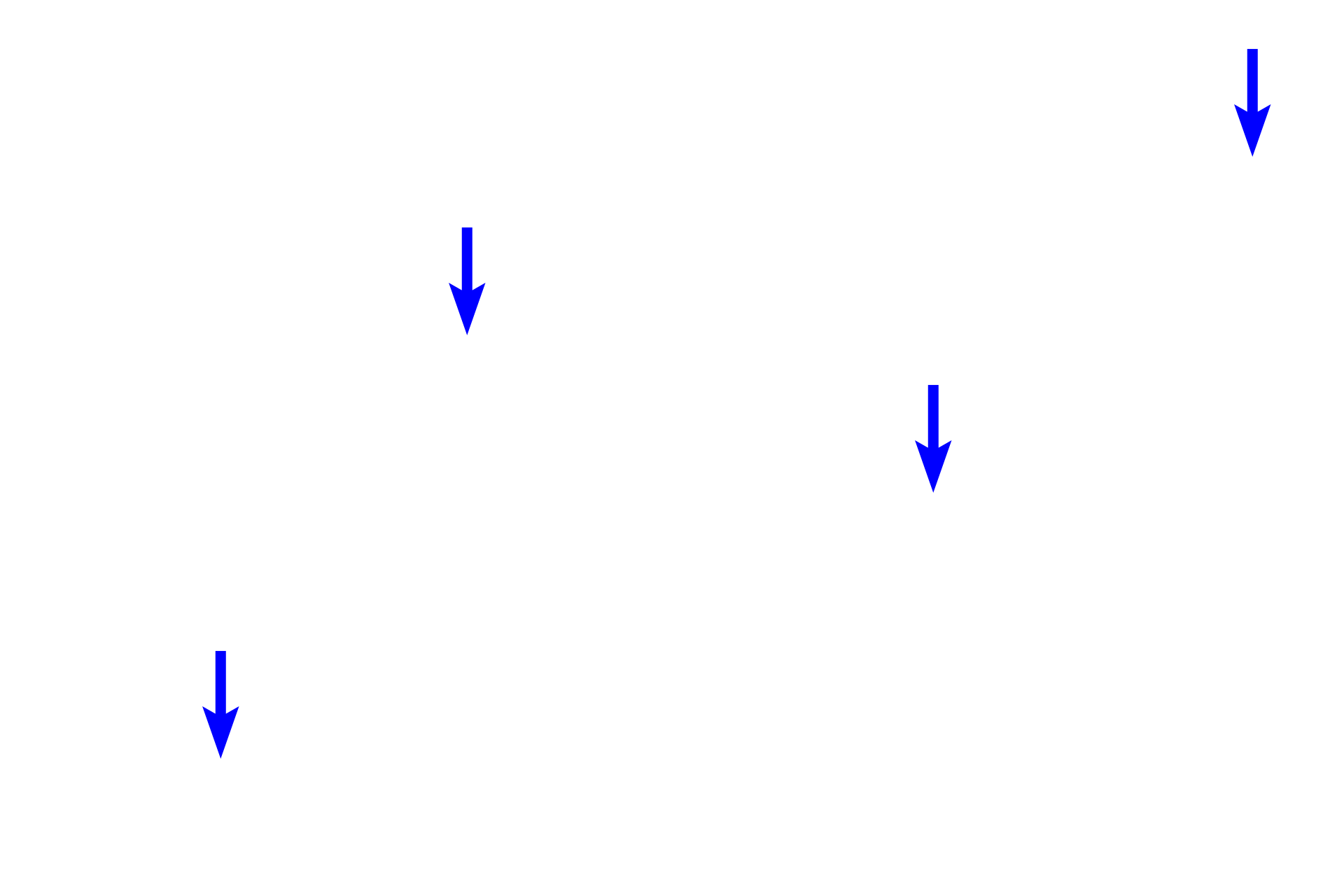 Collagen fibers  (ls) <p>Dense irregular connective tissue has irregularly arranged, thick, interwoven collagen bundles and fibers.  The fibroblasts are mostly inactive and have little cytoplasm.  Dense connective tissue contains fewer cells and less ground subtsance than does loose connective tissue.  Dense irregular connective tissue is found in areas where multidirectional strength is needed.  400x </p>
