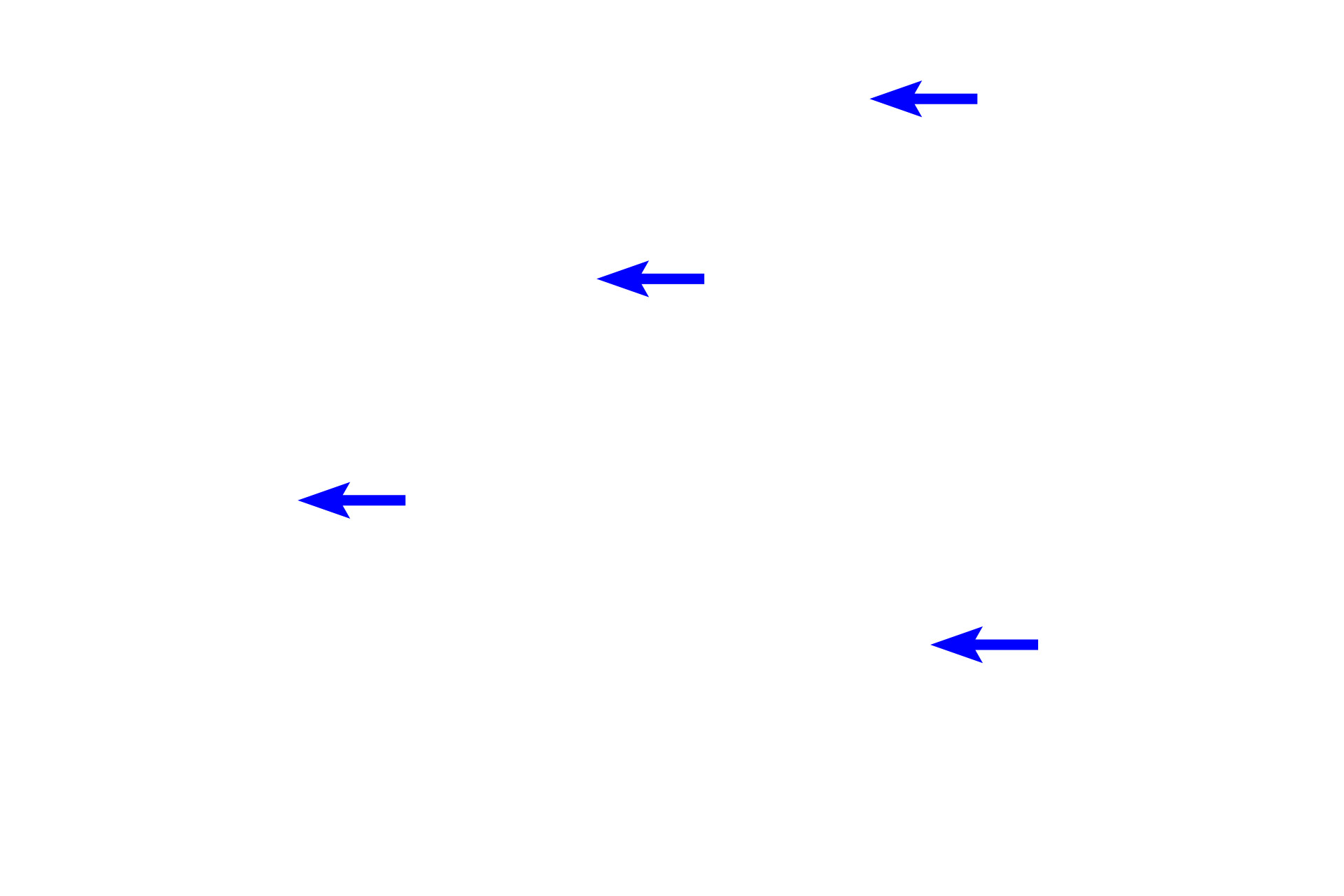 Fibroblast nuclei <p>Dense irregular connective tissue has irregularly arranged, thick, interwoven collagen bundles and fibers.  The fibroblasts are mostly inactive and have little cytoplasm.  Dense connective tissue contains fewer cells and less ground substance than does loose connective tissue.  Dense irregular connective tissue is found in areas where multidirectional strength is needed.  400x </p>
