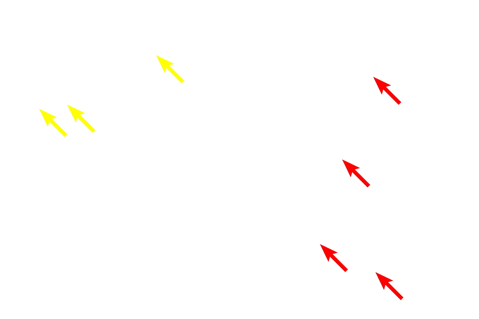 Collagen fibers (xs) <p>These images compare dense irregular connective tissue stained to reveal elastic fibers. On the left, the Verhoeff method stains elastic fibers black and collagen fibers red. The image on the right shows similar tissue stained by the Movat pentachrome method, which includes the Verhoeff method as one of its five stains. Collagen fibers are stained yellow. The Verhoeff method targets the protein elastin, the major component of elastic fibers.  Elastic fibers are present in all types of connective tissue proper to provide a certain degree of stretchability. 400x</p>
