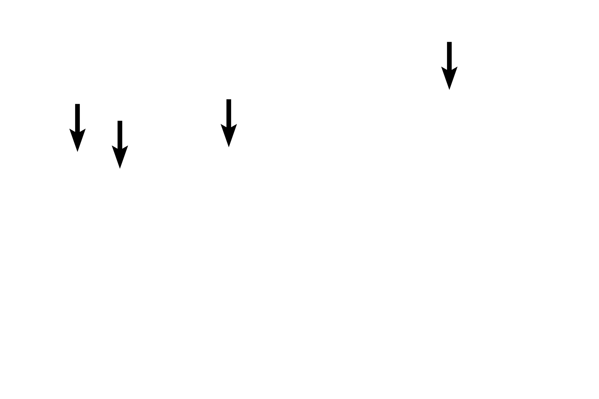 Inactive fibroblast nuclei <p>Dense irregular connective tissue provides sturdy support, such as in capsules around organs. Extensions from the capsule, called trabeculae, project into the organ, providing additional structural support for the parenchyma as well as forming internal compartments and subdivisions. Active and inactive fibroblasts are present among the densely arranged collagen fibers. Spleen 200x</p>
