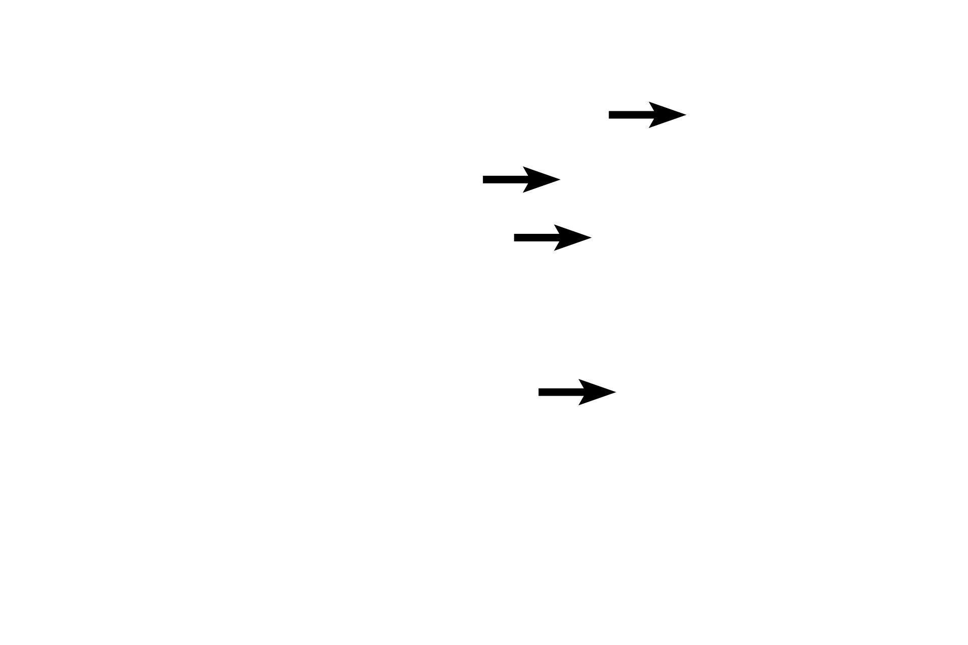 Active fibroblast nuclei <p>Dense irregular connective tissue provides sturdy support, such as in capsules around organs. Extensions from the capsule, called trabeculae, project into the organ, providing additional structural support for the parenchyma as well as forming internal compartments and subdivisions. Active and inactive fibroblasts are present among the densely arranged collagen fibers. Spleen 200x</p>
