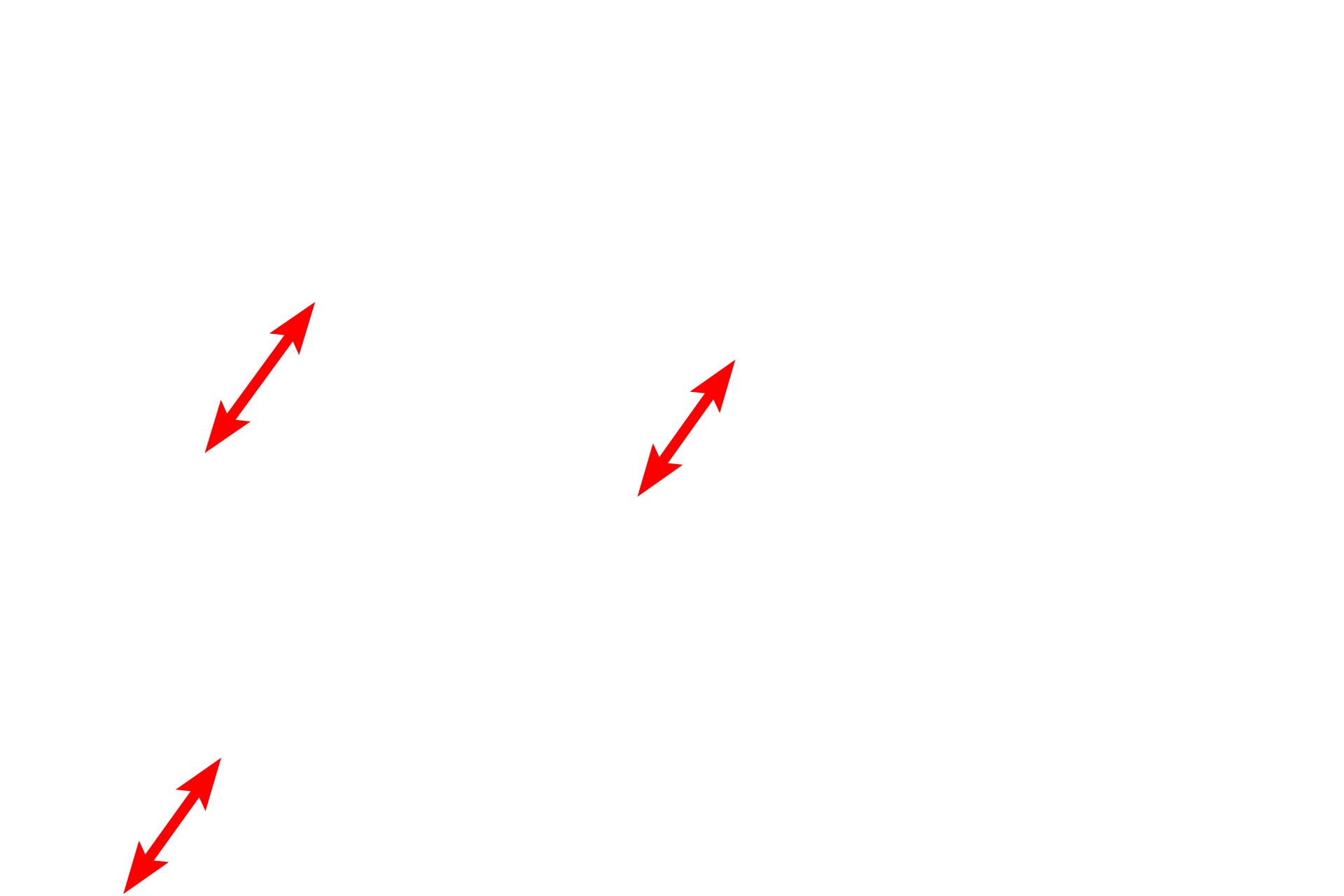 Collagen bundles <p>This electron micrograph of dense irregular connective tissue demonstrates large collagen bundles, composed of numerous collagen fibrils, and dark elastic fibers criss-crossing the tissue. An active fibroblast, which synthesizes both elastic and collagen fibers, is present in the lower part of the image. Dermis of the skin 5000x</p>
