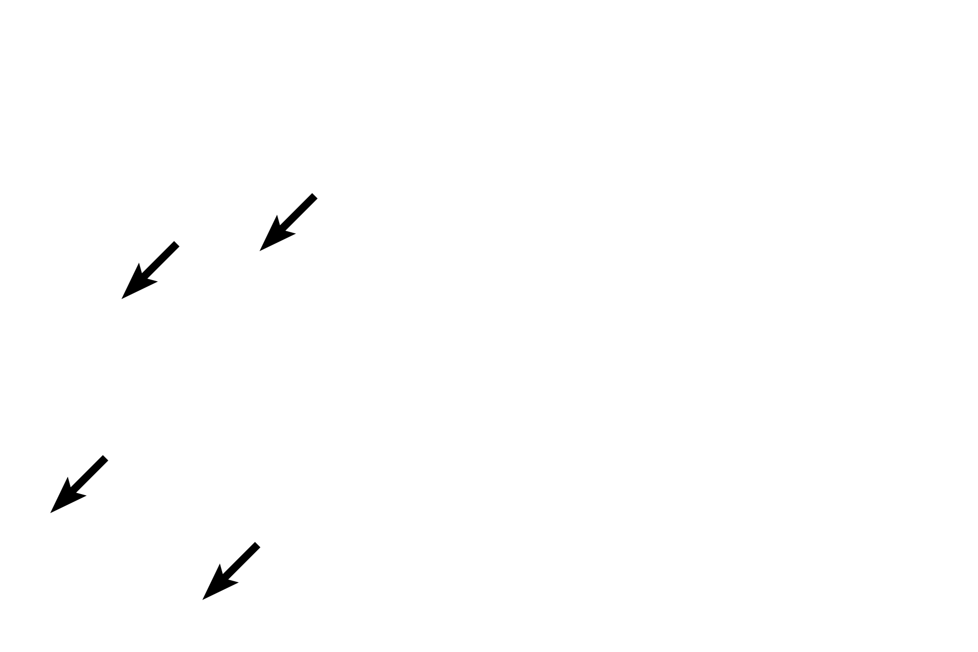 Inactive fibroblast nuclei > <p>Compared with active fibroblasts, inactive fibroblasts have smaller, more heterochromatic nuclei.</p>
