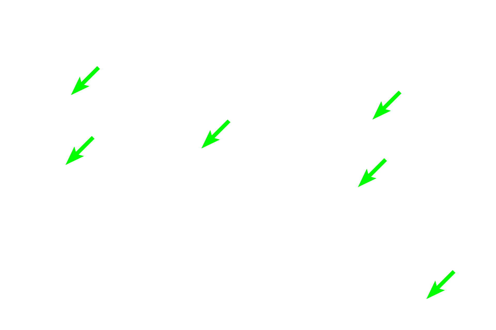 Collagen fibers  <p>Dense connective tissue is further subdivided into irregular and regular categories, based the arrangement of the collagen fibers. In dense irregular connective tissue (left) fibers are multidirectional and interlaced. In dense regular connective tissue (right) fibers are arranged in a highly ordered, parallel manner. Dense irregular is present throughout the body while dense regular is highly restricted, forming tendons and ligaments. In both irregular and regular, the cells are almost exclusively fibroblasts. 400x, 400x</p>
