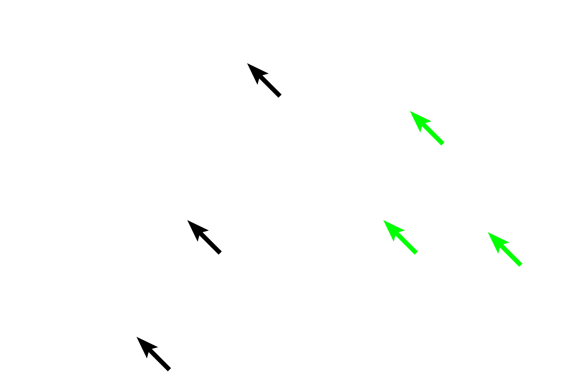Fibroblast nuclei <p>Connective tissue consists of cells and an extracellular matrix composed of fibers (collagen, reticular and elastic), ground substance and tissue fluid. Ground substance, primarily proteoglycans, is present as a gel in connective tissue proper, where it surrounds cells and fibers, and serves as padding between other tissues and organs of the body. 400x, 400x</p>
