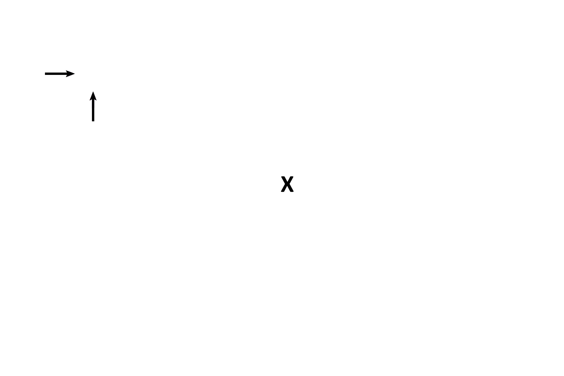 Vestibule > <p>The vestibule is the large perilymph-filled space of the osseous labyrinth. The vestibule contains two components of the membranous labyrinth, the utricle and the saccule.</p>
