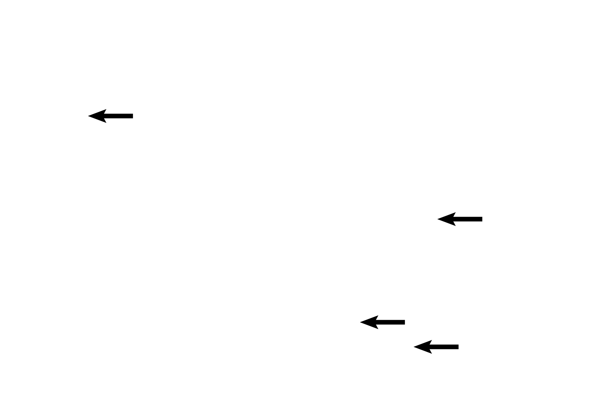 Spermatogonia <p>The germinal epithelium of the convoluted portions of the seminiferous tubules is composed of Sertoli cells, diploid spermatogonia and primary spermatocytes, and haploid secondary spermatocytes and spermatids. 1000x </p>