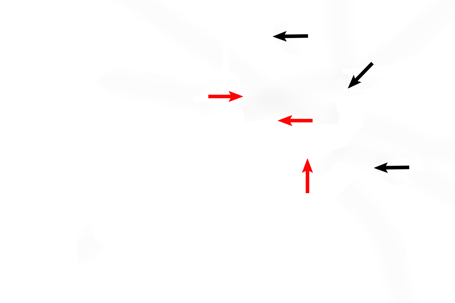 Semicircular canals > <p>The semicircular canals are three tubular spaces (black arrows) that communicate with and lie posterolaterally to the vestibule. The canals are oriented in three, mutually perpendicular planes. An enlargement (red arrows) at one end of each canal, adjacent to the vestibule, houses the ampulla of each semicircular duct.</p>
