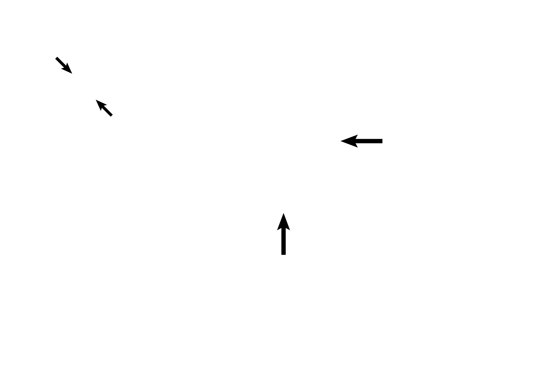 Vestibule <p>Three membranous semicircular ducts are shown. One is visible at its attachment with the utricle, just beginning to enter its semicircular canal. The second is sectioned at a distance from the utricle, lying in its bony semicircular canal. The third semicircular duct is represented by its ampulla and the enclosed crista ampullaris. 30x</p>
