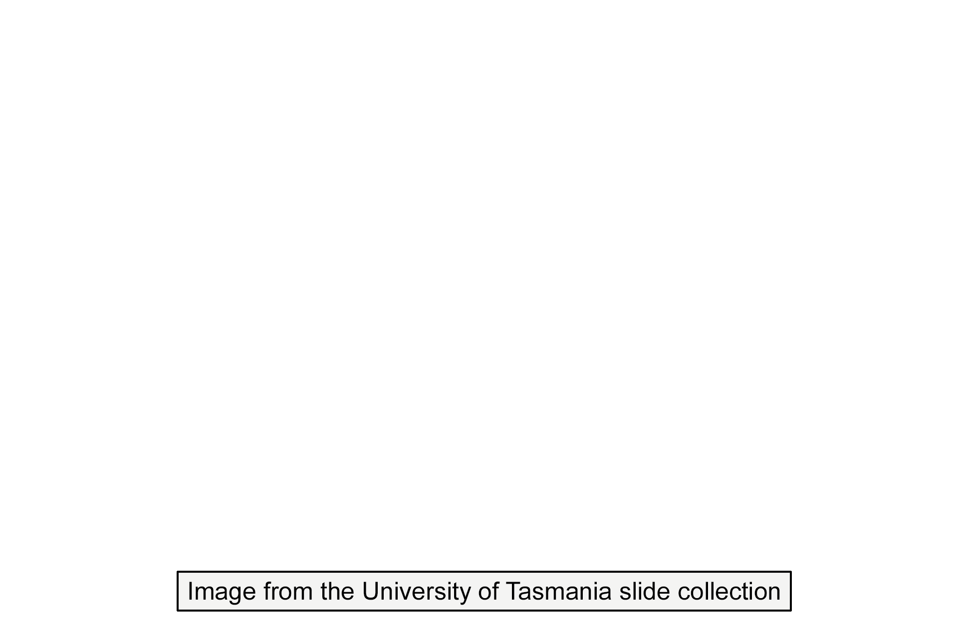 Image source > <p>This image was taken from a slide in the University of Tasmania slide collection.</p>

