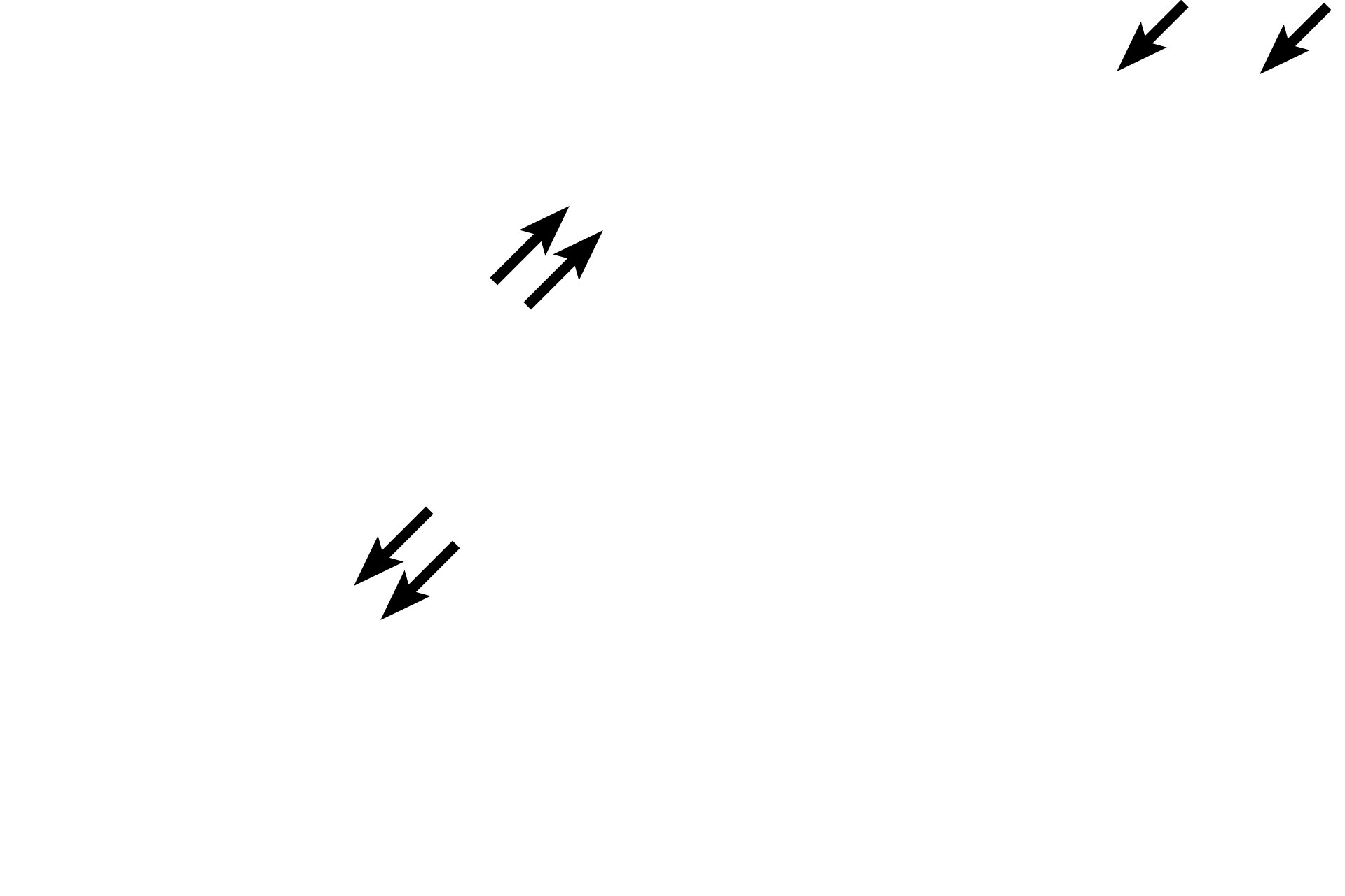 Tunica intima > <p>The tunica intima faces the blood. This layer is very thin compared to the thickness of the arterial wall and consists of an endothelium and underlying connective tissue. The tunica intima can only be distinguished at the higher magnification on the right.</p>
