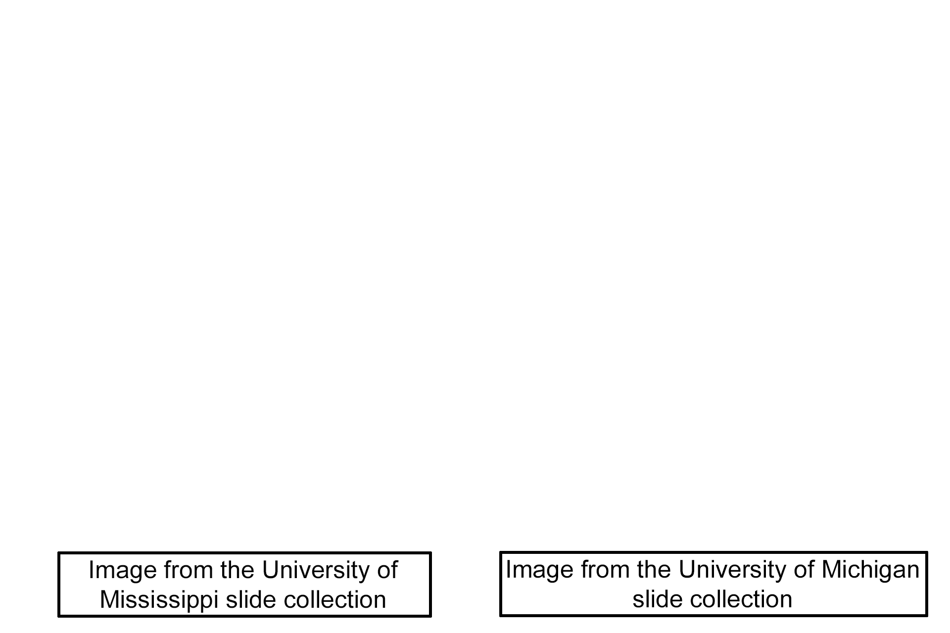 Image sources > <p>The image on the left was taken of a slide in the University of Mississippi collection. The image on the right was taken of a slide in the University of Michigan collection.</p>