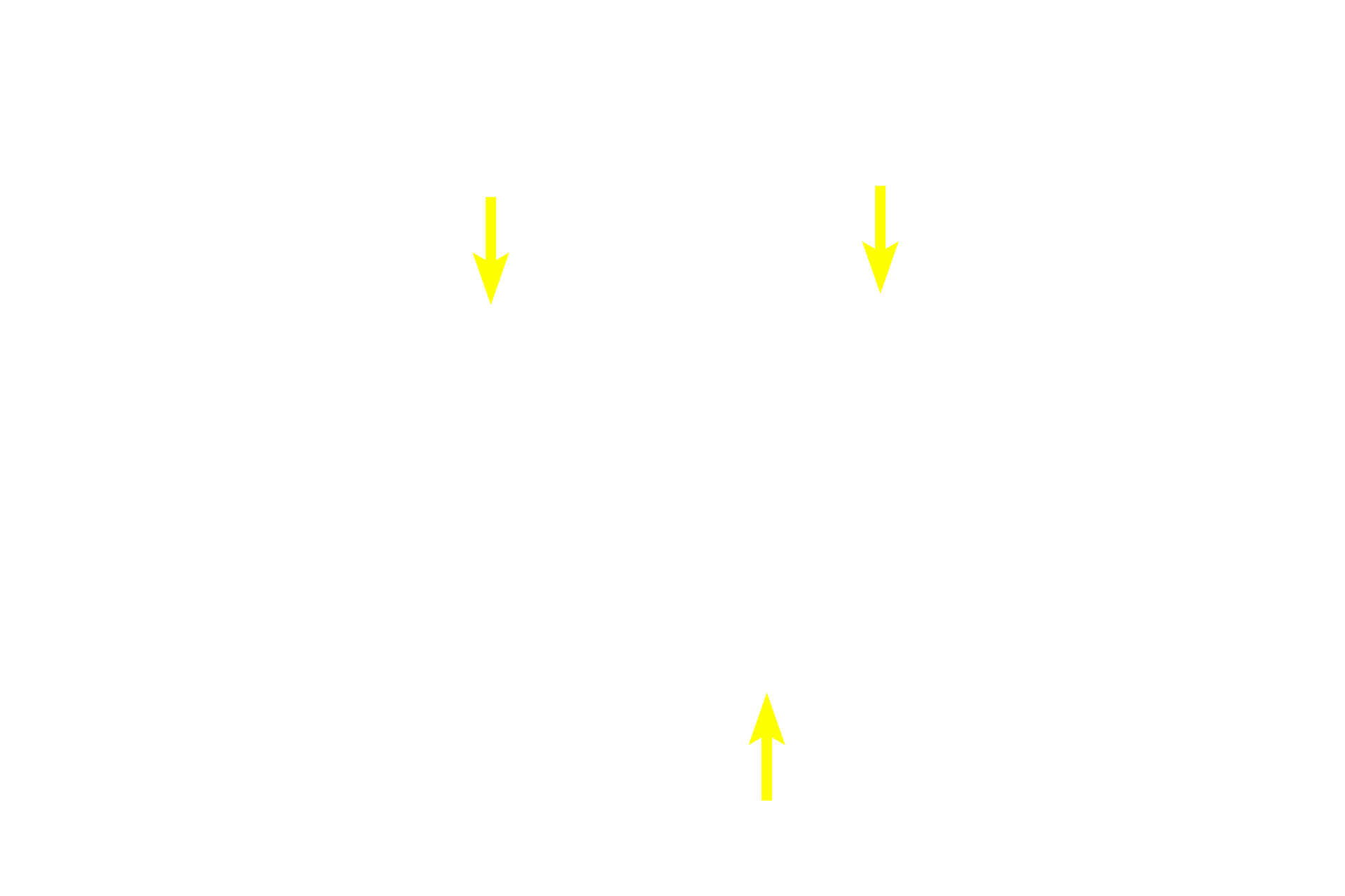 Epithelium <p>Cartilage plates and mixed glands are not present in bronchioles. In large bronchioles, such as the one seen here, the epithelium remains pseudostratified columnar with cilia and goblet cells; the lamina propria contains a smooth muscle layer represented as bands spiraling around the bronchiole. Other changes occur as the passageway decreases in diameter. 100x</p>
