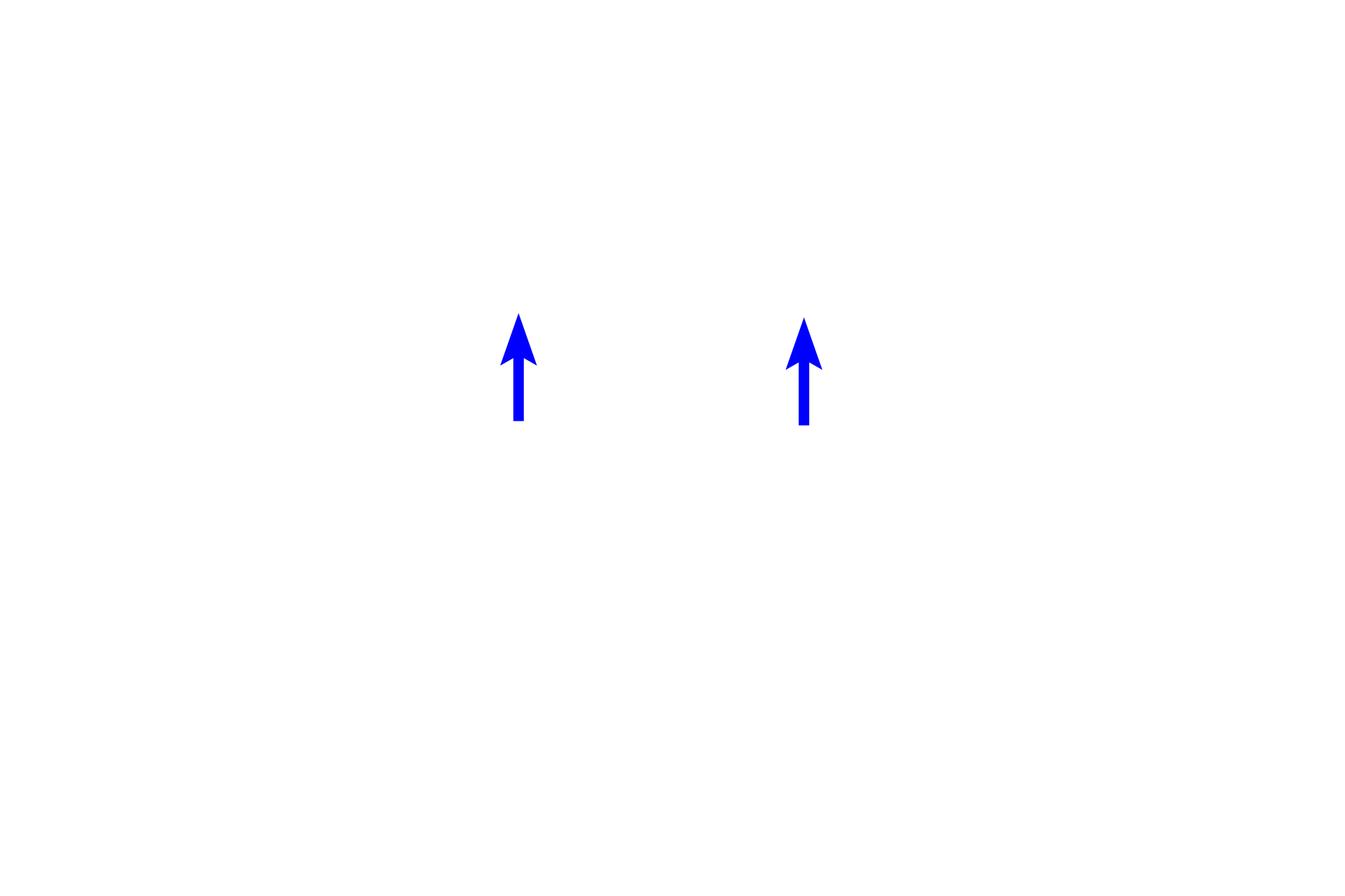  - Cilia <p>Cartilage plates and mixed glands are not present in bronchioles. In large bronchioles, such as the one seen here, the epithelium remains pseudostratified columnar with cilia and goblet cells; the lamina propria contains a smooth muscle layer represented as bands spiraling around the bronchiole. Other changes occur as the passageway decreases in diameter. 100x</p>
