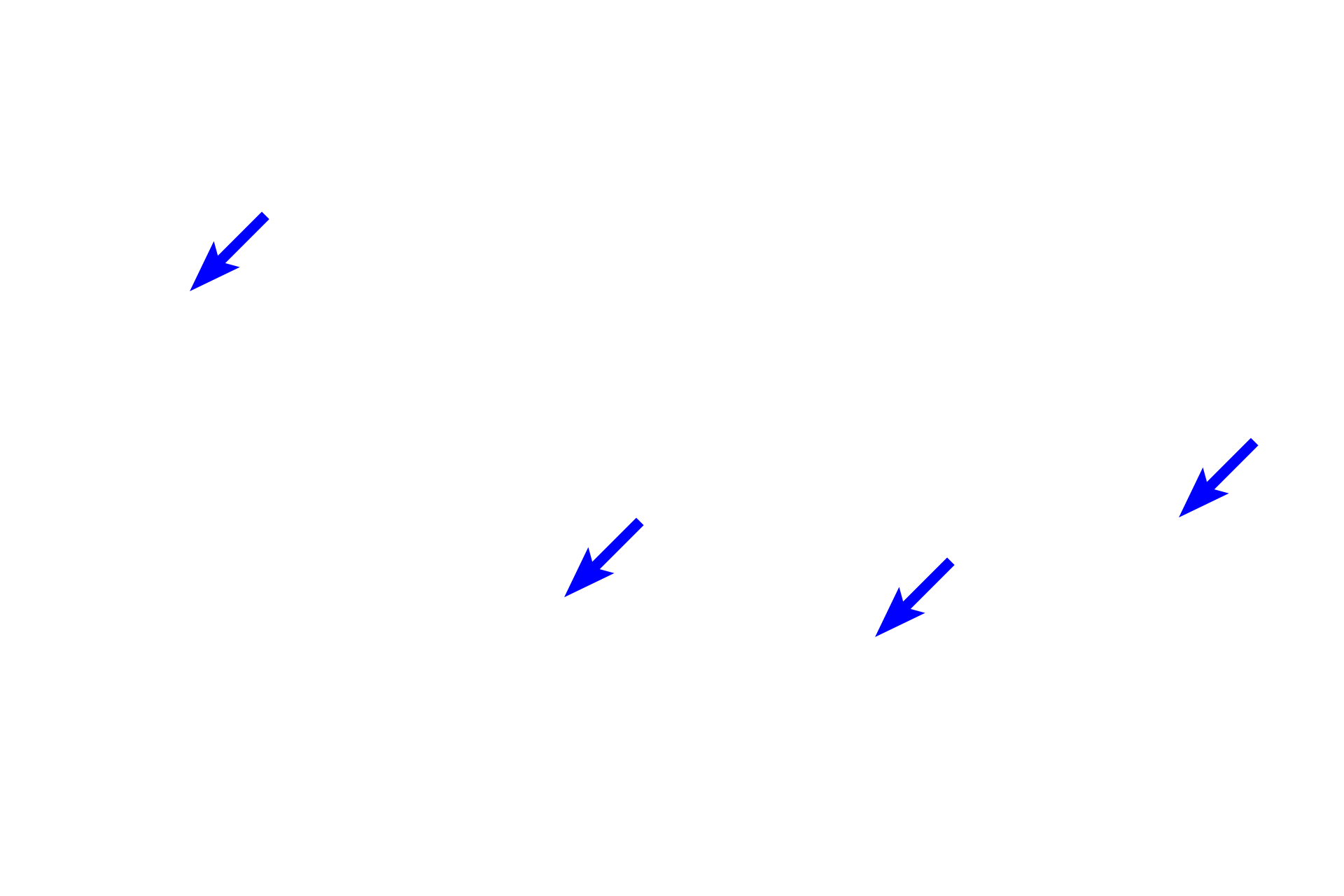 Cartilage plates > <p>Cartilage plates are present in secondary bronchi, but they do not persist into the bronchiole.  Secondary bronchi also possess mixed glands, however, they are not present in this section.</p>
