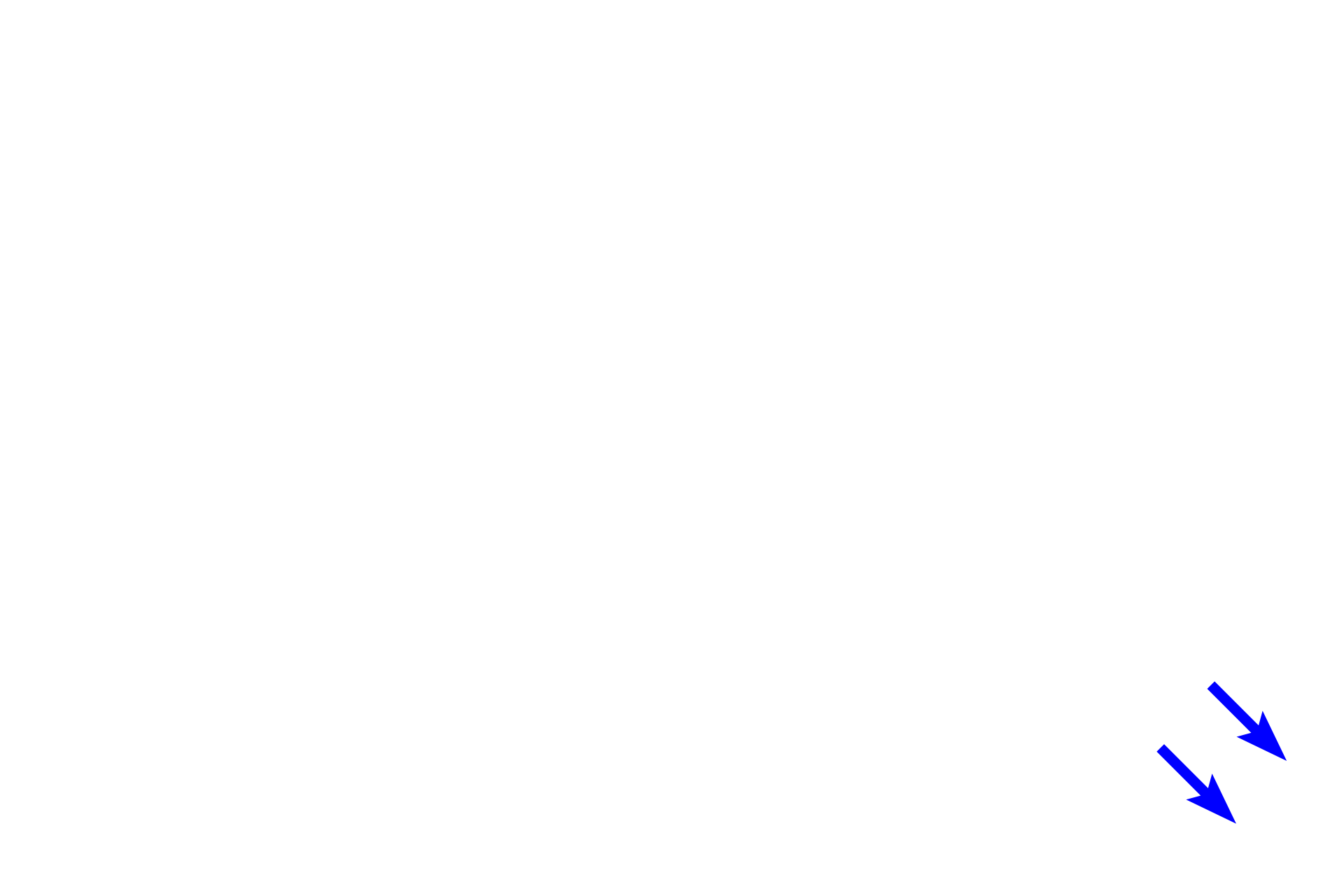 Pulmonary vein > <p>A portion of a pulmonary vein is visible in the lower right, surrounded by alveoli.  This vessel is conveying oxygenated blood out of the lung.</p>
