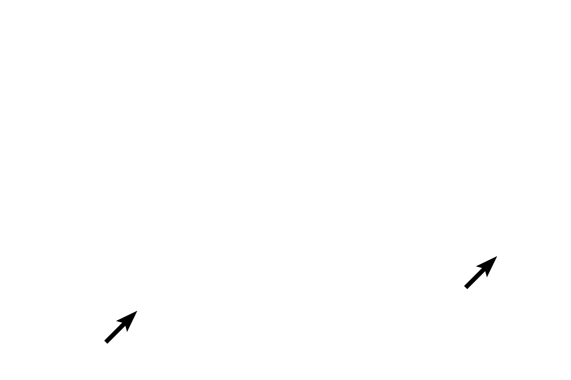 Pulmonary artery > <p>These vessels accompany the respiratory passageway carrying deoxygenated blood to the alveoli.</p>
