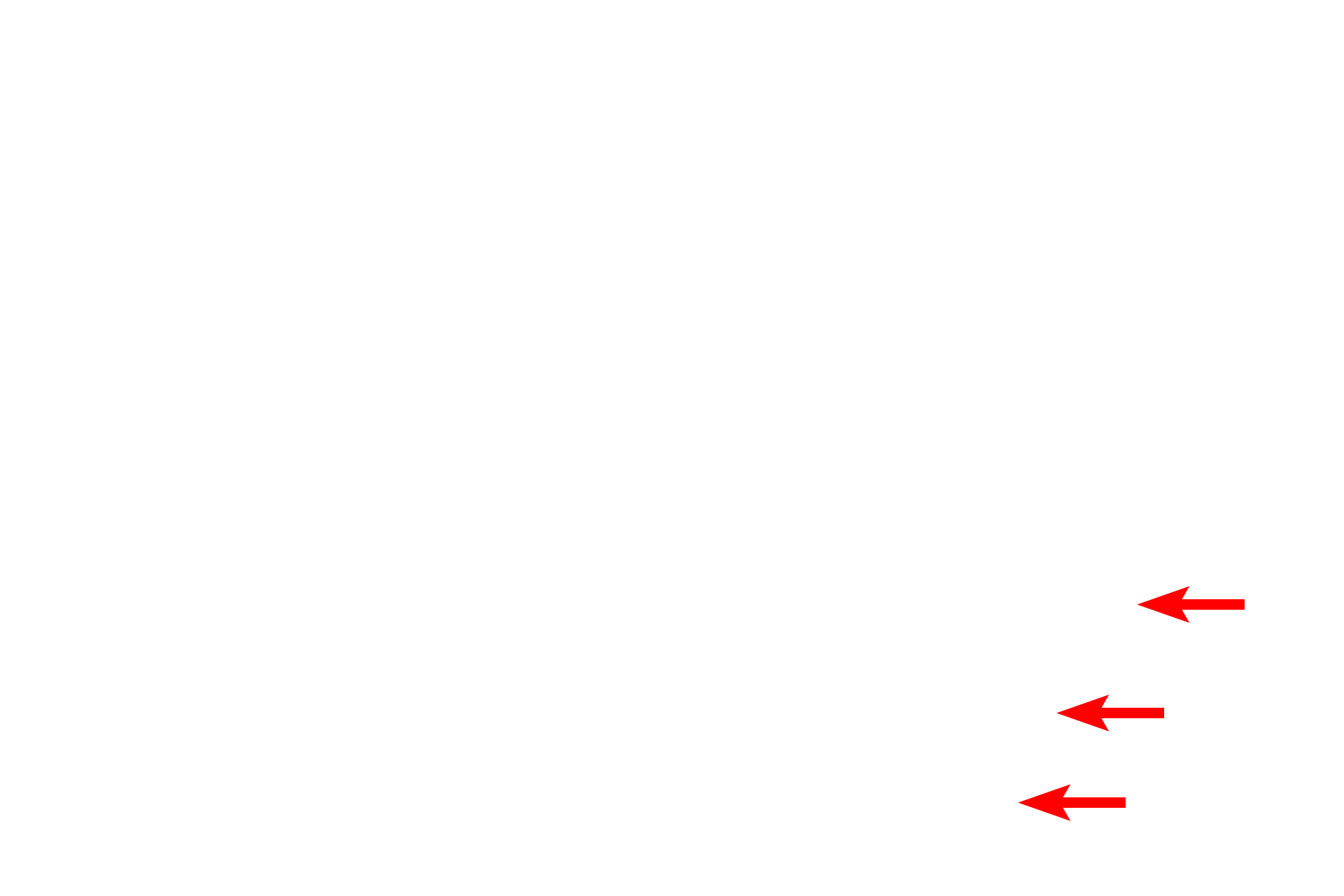  - Hair follicles <p>This image shows a sagittal section of the lip.  The external surface of the lip is covered by skin with a thin, stratified squamous keratinized epithelium and hair follicles (on right).  The skin transitions to the vermillion zone (red margin) which forms the red portion of the lip, followed by the oral mucosa which lines the inner portion of the lip.  Beneath the oral mucosa are numerous minor salivary glands (labial glands).  The orbicularis oris muscle (skeletal) occupies the central core of the lip.  (Iron hematoxylin/alcian blue stain) 100x, 10x</p>
