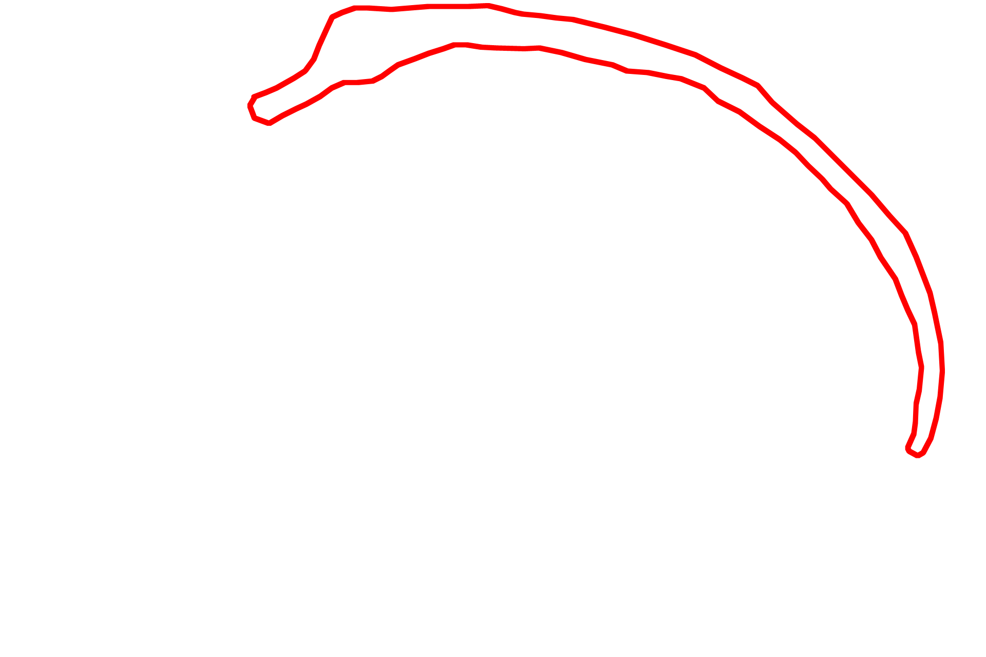 Vermillion zone > <p>The vermilion zone, the red portion of the lip, is covered by a keratinized stratified squamous epithelium that lacks hair follicles.  The epithelium in this region is thicker than the epithelium of the skin and a stratum granulosum is present, indicating that the epithelium is keratinized.</p>
