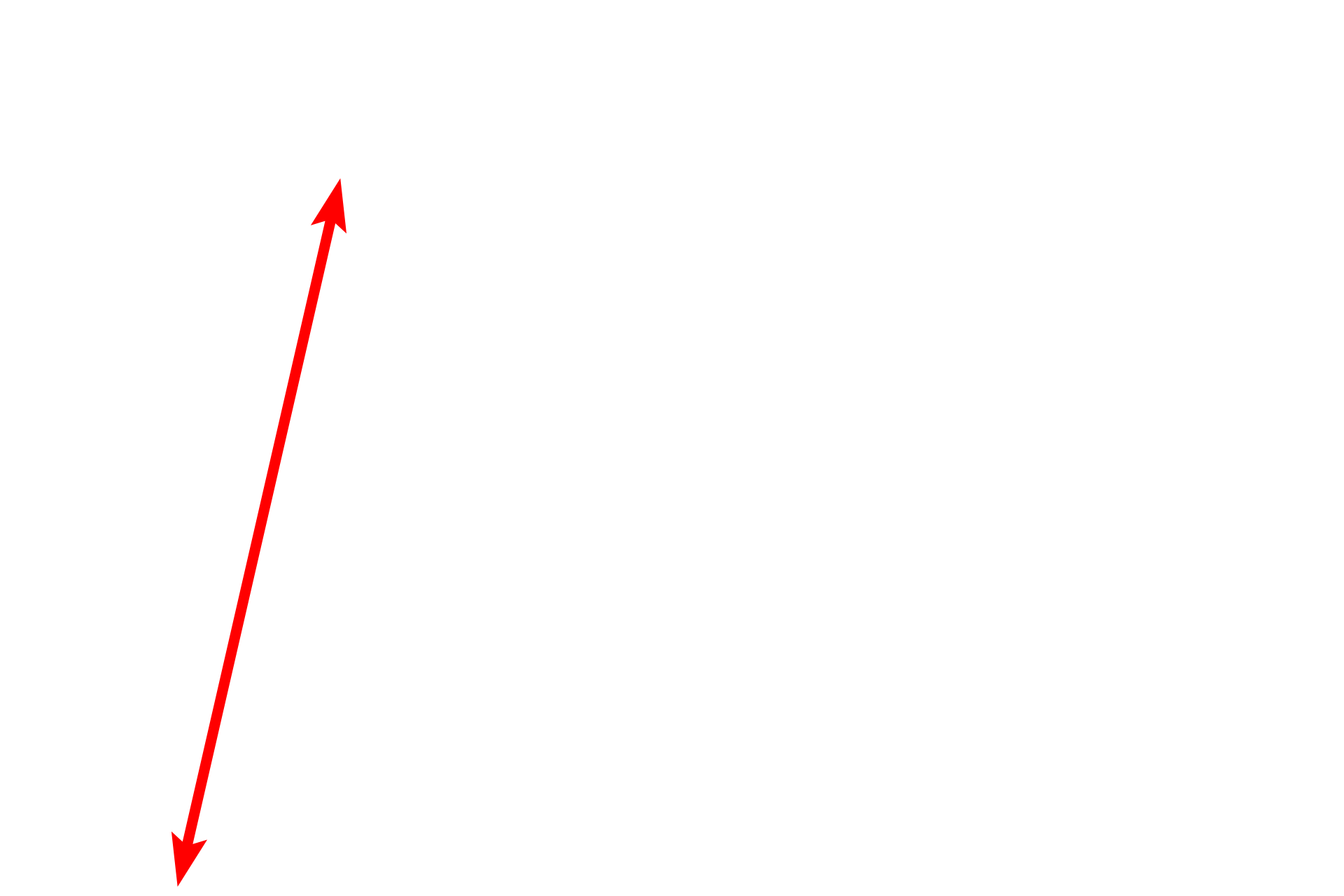 Oral (lining) mucosa > <p>The inner portion of the lip is lined by oral mucosa with a thick stratified squamous moist epithelium and prominent dermal papillae.  The epithelium of the lining mucosa lacks a stratum granulosum.</p>
