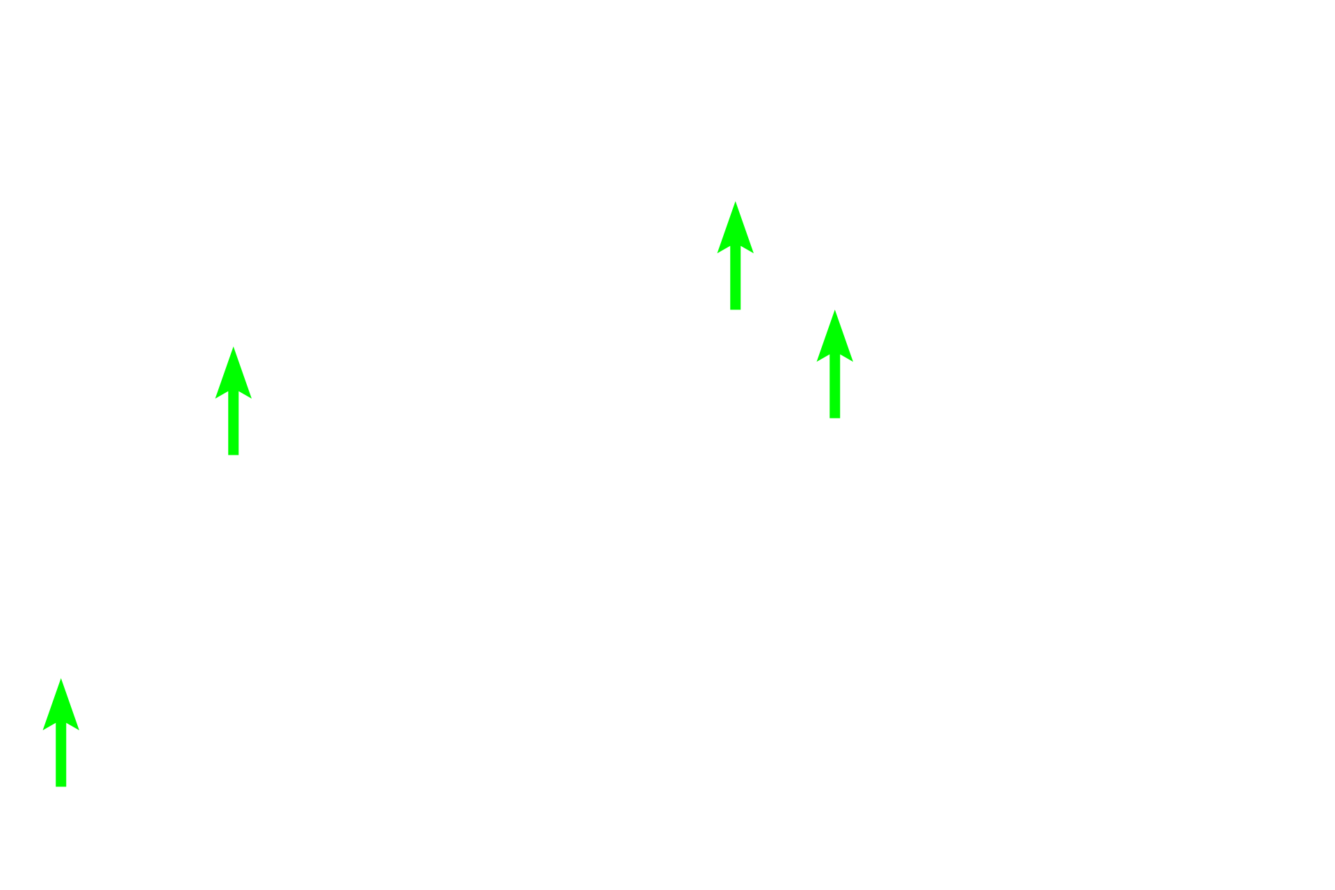 Osteoclasts > <p>Osteoclasts lie on bony surfaces and are large cells with multiple nuclei and pink-staining cytoplasm. They breakdown (resorb) bone. Osteoclasts belong to the monocyte lineage and are not related to osteoblasts or osteocytes. As shown here, both bone deposition and bone resorption can occur adjacent to each other along a single portion of bone.</p>
