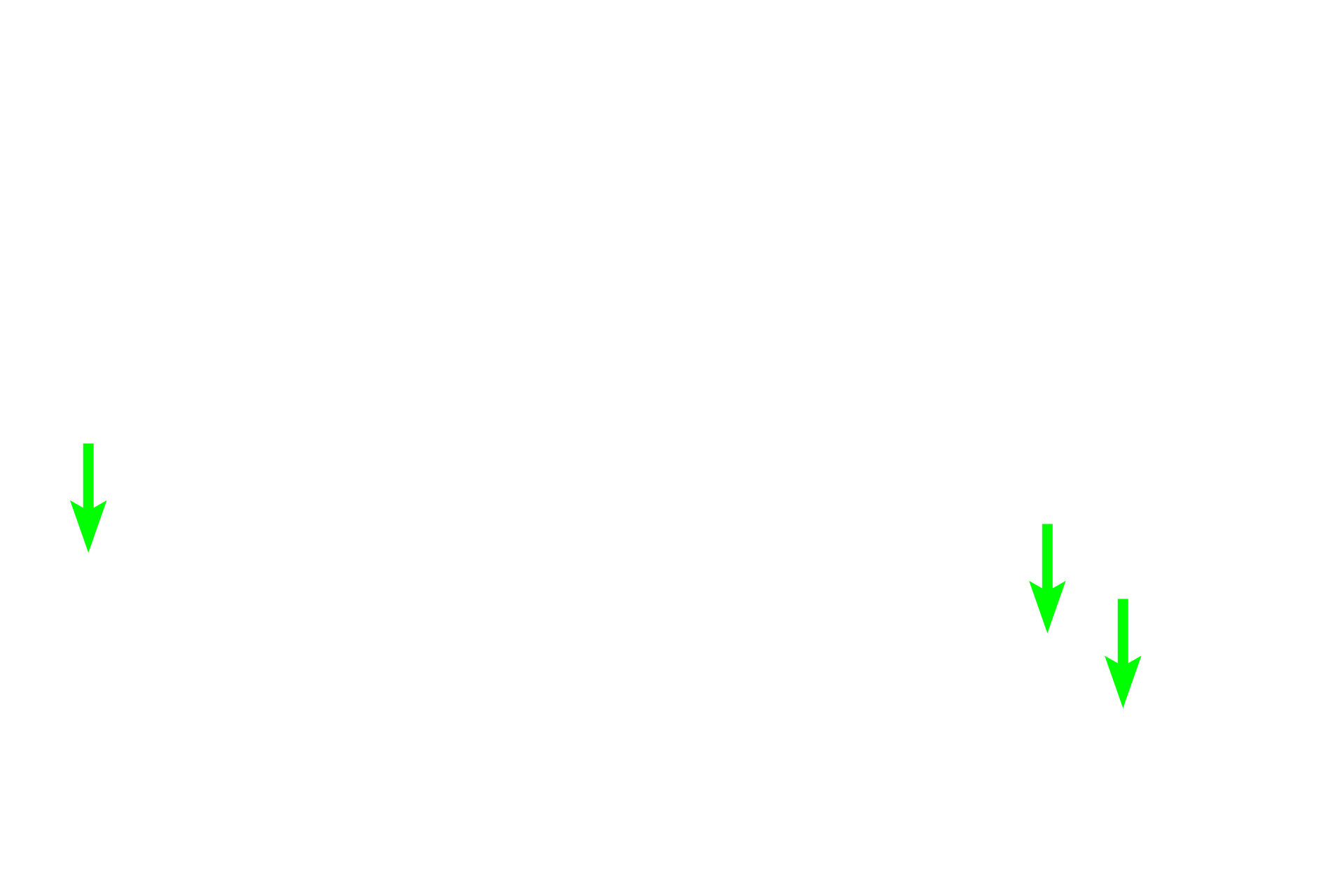  - Osteoid > <p>Osteoid is composed of ground substance and collagen fibers. It appears as a pale band lying on the bone surface beneath the active osteoblasts. Osteoid later becomes mineralized to form the matrix.</p>
