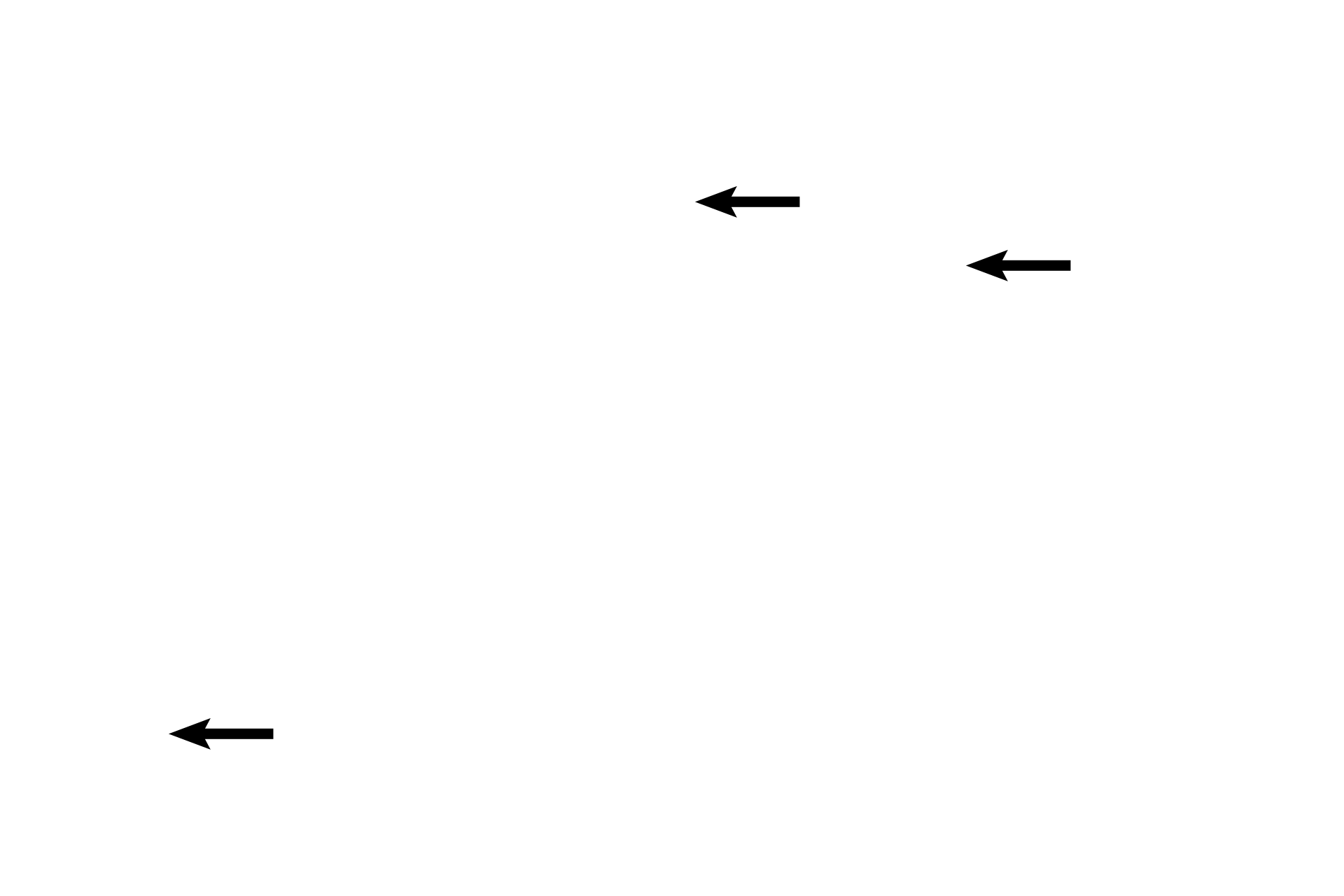 Oocytes > <p>Each primordial and primary follicle contains a primary oocyte. Each oocyte increases in diameter as the follicular cells increase in size and number.</p>
