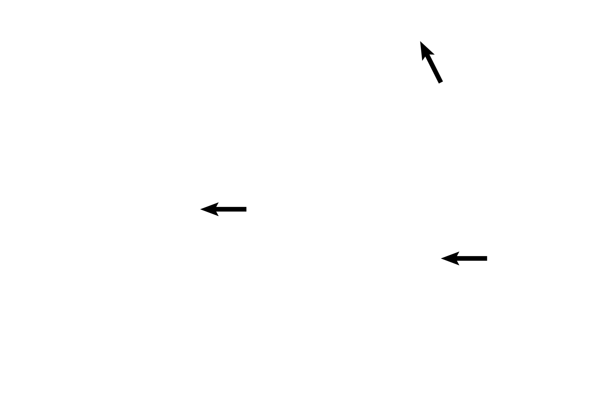 Stromal cells > <p>Stromal cells are located in the connective tissue surrounding the follicles.  These connective tissue cells are multipotential and produce not only the connective tissue stroma of the ovary, but also differentiate into the thecal layers that surround advanced follicles. </p>
