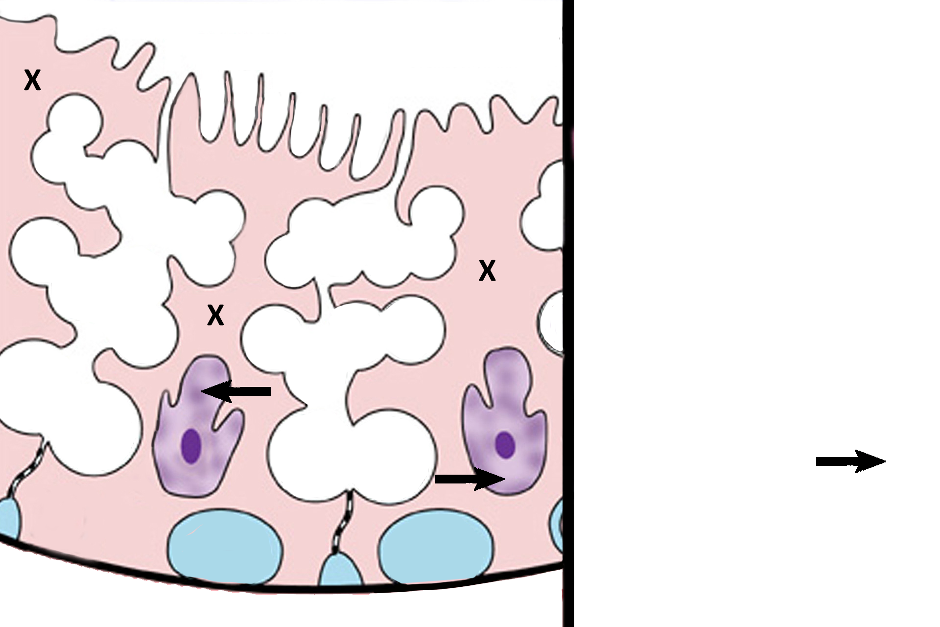 Sertoli cells > <p>Sertoli cells (X) extend from the basal lamina to the lumen. Their nuclei (arrows) are ovoid, have a prominent nucleolus, are usually indented, and lie perpendicular to the basal lamina. Sertoli cells extend numerous lateral processes that “bear hug” developing germ cells and form occluding junctions with adjacent Sertoli cells. These occluding junctions establish the blood-testis barrier.</p>

