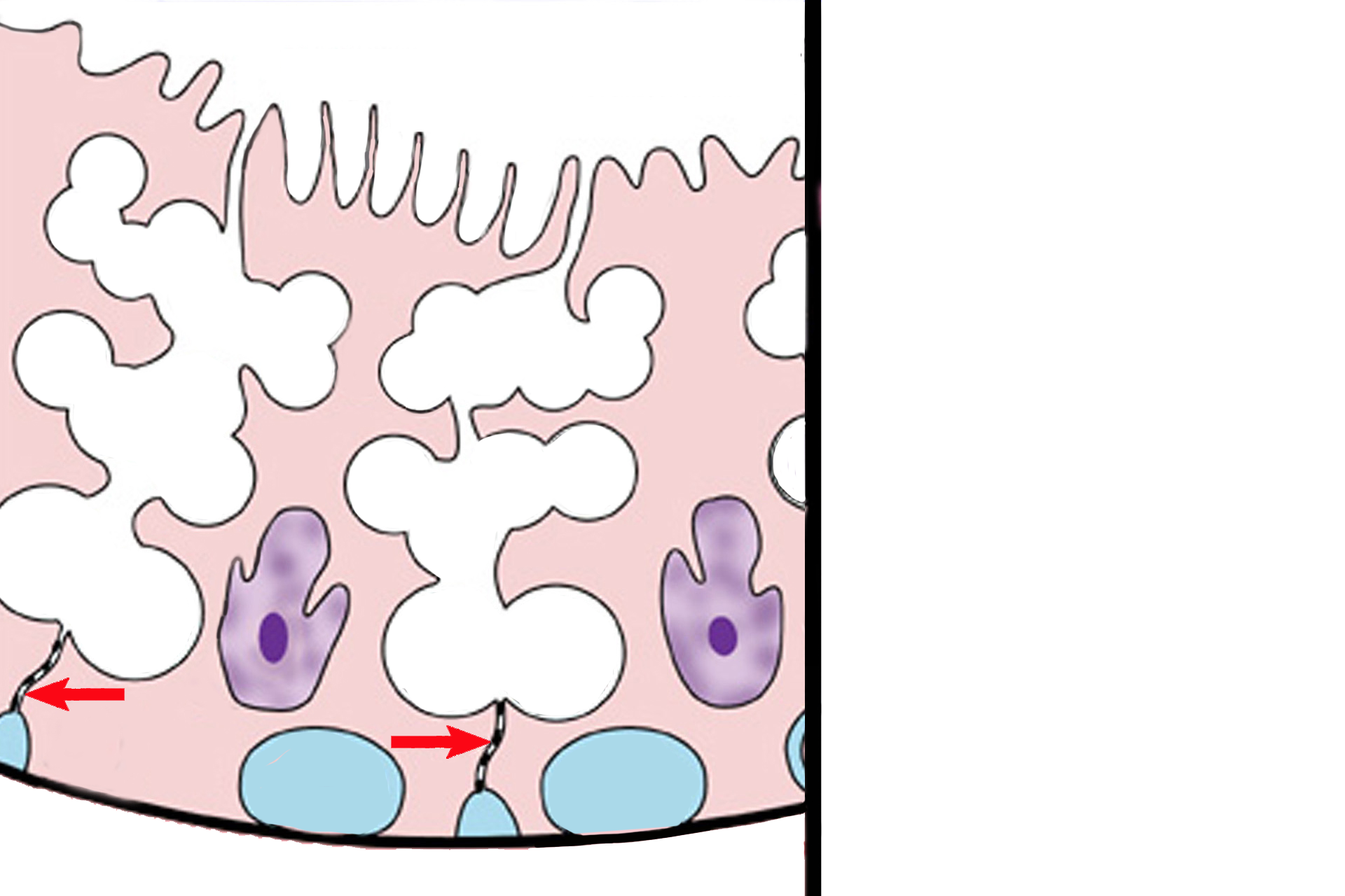 Blood-testis barrier > <p>The blood-testis barrier creates two compartments in the germinal epithelium to protect developing sperm against any potential immune response. The barrier is formed by occluding junctions (arrows) joining adjacent Sertoli cells. The basal compartment (blue fill) contains cells that are exposed to blood-born factors. The adluminal compartment (white fill) isolates developing germ cells (gametes), thus protecting them from potential immune responses brought about by exposure to blood. </p>
