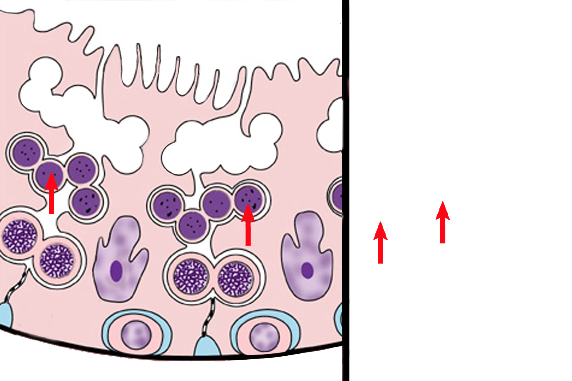  - Secondary spermatocytes > <p>Secondary spermatocytes are haploid cells formed by the first meiotic division of primary spermatocytes. Secondary spermatocytes are located closer to the lumen than are primaries, and their nuclei are about the same diameter as those of spermatogonia. Secondary spermatocytes quickly complete the second meiotic division, so they are not frequently seen.  </p>
