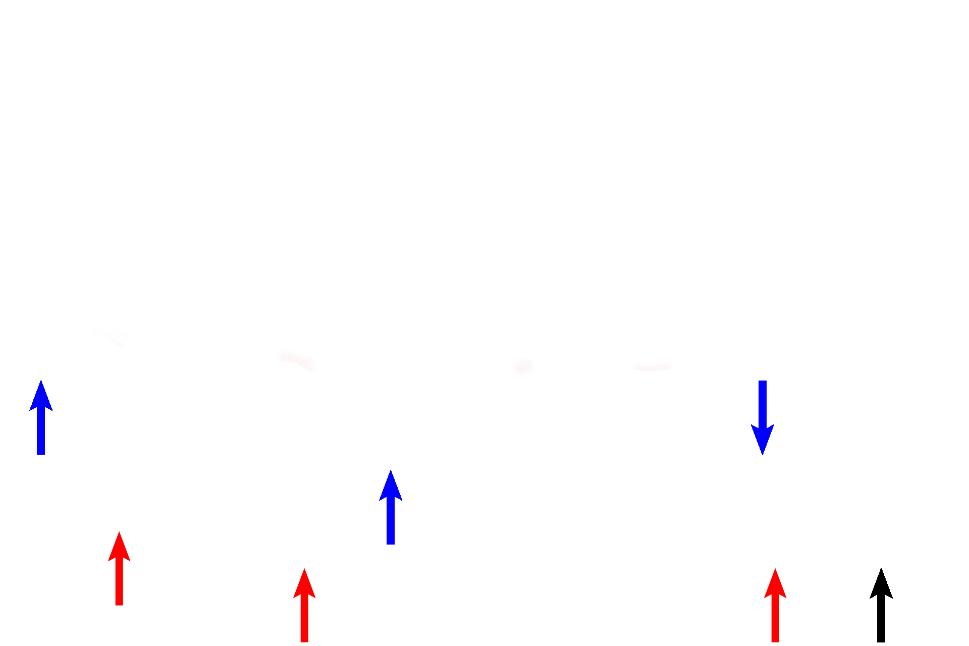 Spermatocytogenesis > <p>Spermatogonia (red arrows) divide by mitosis (black arrow on right) to perpetuate themselves or to form primary spermatocytes (blue arrows), a process called spermatocytogenesis. Primary spermatocytes are located first in the basal compartment (below the dotted line on the right) but migrate through the blood-testis barrier into the adluminal compartment.</p>
