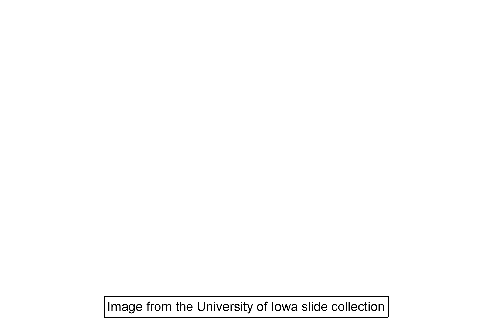 Image source > <p>The image was taken of slide in the University of Iowa collection</p>
