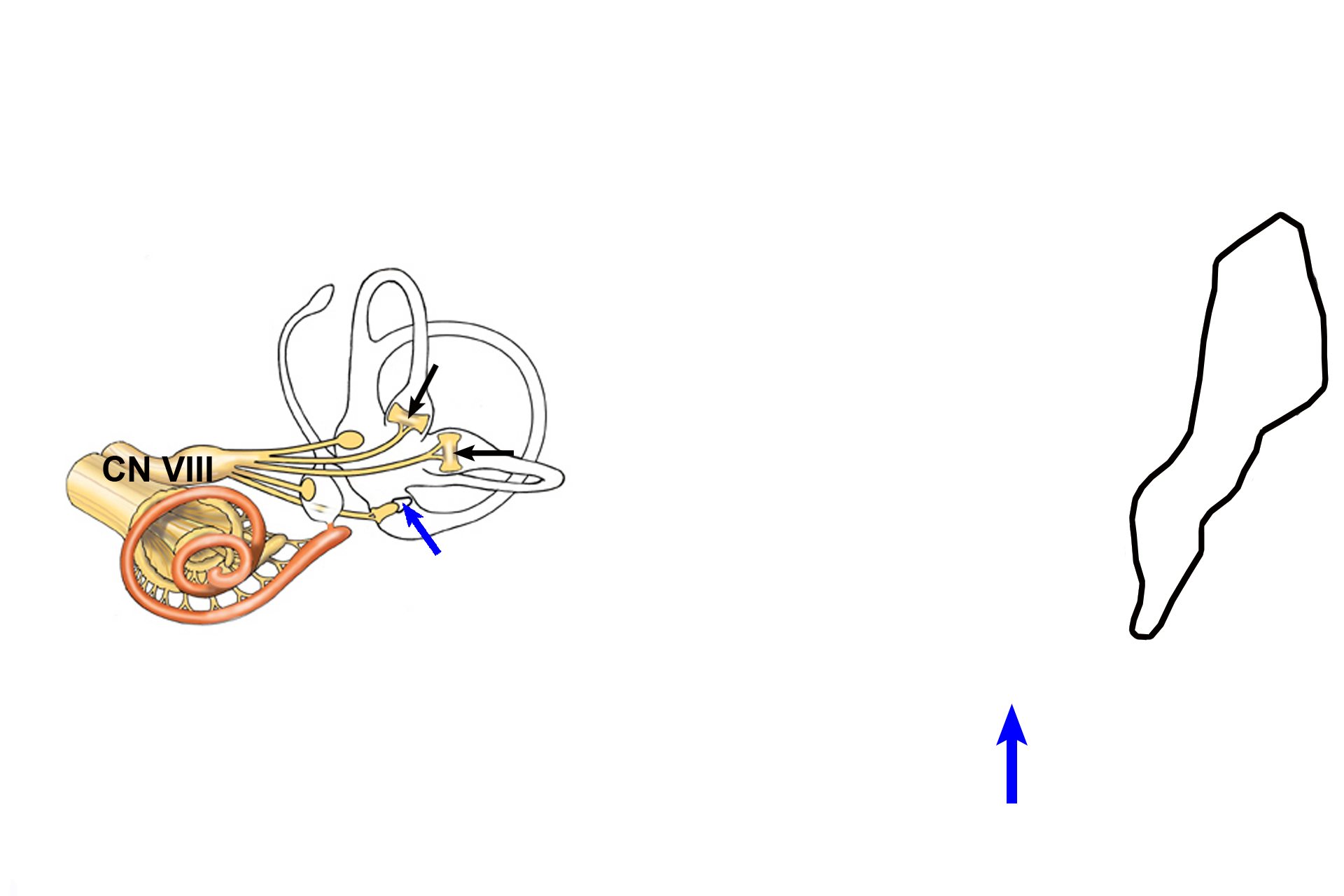 CN VIII > <p>The vestibular division of cranial nerve VIII innervates each crista ampullaris (black arrows) Movement of endolymph, caused by angular acceleration, displaces the gelatinous cupula (blue arrows) and triggers a neural, sensory impulse in this nerve. The cupula in the right image is shown spanning the ampulla. The sensory ganglion of CN VIII (black outline) is also seen.</p>
