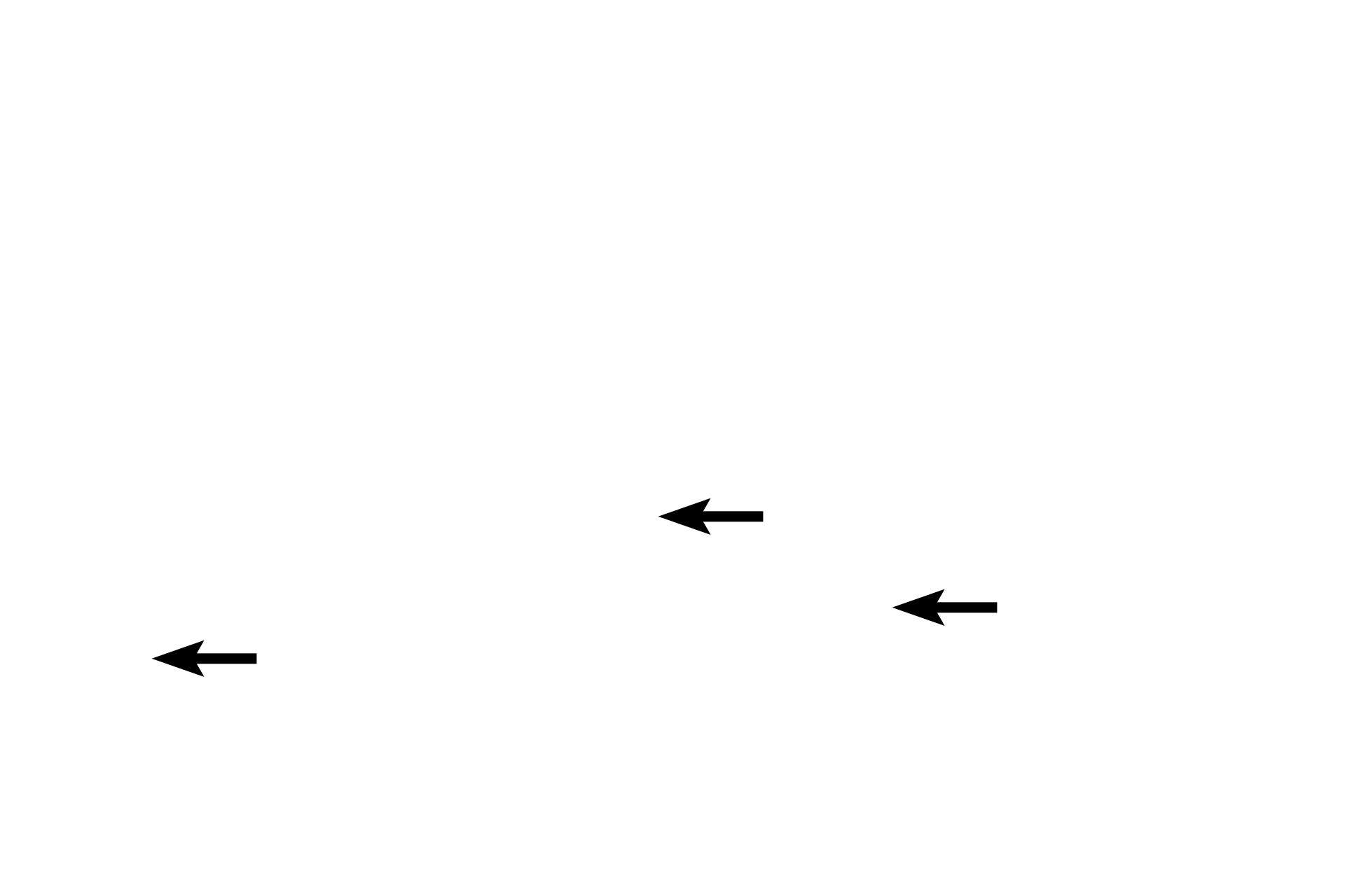 Endosteum > <p>The inner surfaces of bone, except lacunae and canaliculi, are lined by a single layer of flattened endosteal (lining) cells causing this layer to resemble a simple epithelium.</p>
