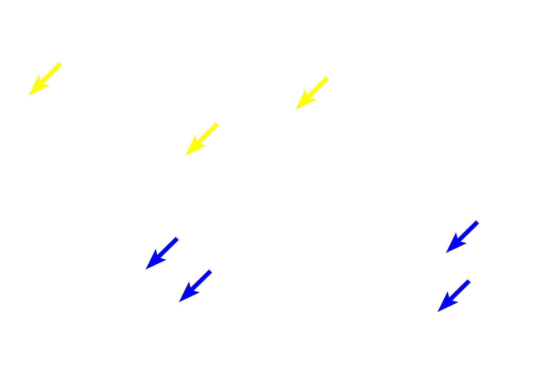  - Nuclear bag fibers <p>Intrafusal fibers are multinucleated with nuclei occupying the central regions of the cell.  Nuclear chain fibers are slender and have nuclei arranged end-to-end in a chain-like fashion.  Nuclear bag fibers are larger and their nuclei cluster centrally, giving the mid-region a swollen appearance.</p>
