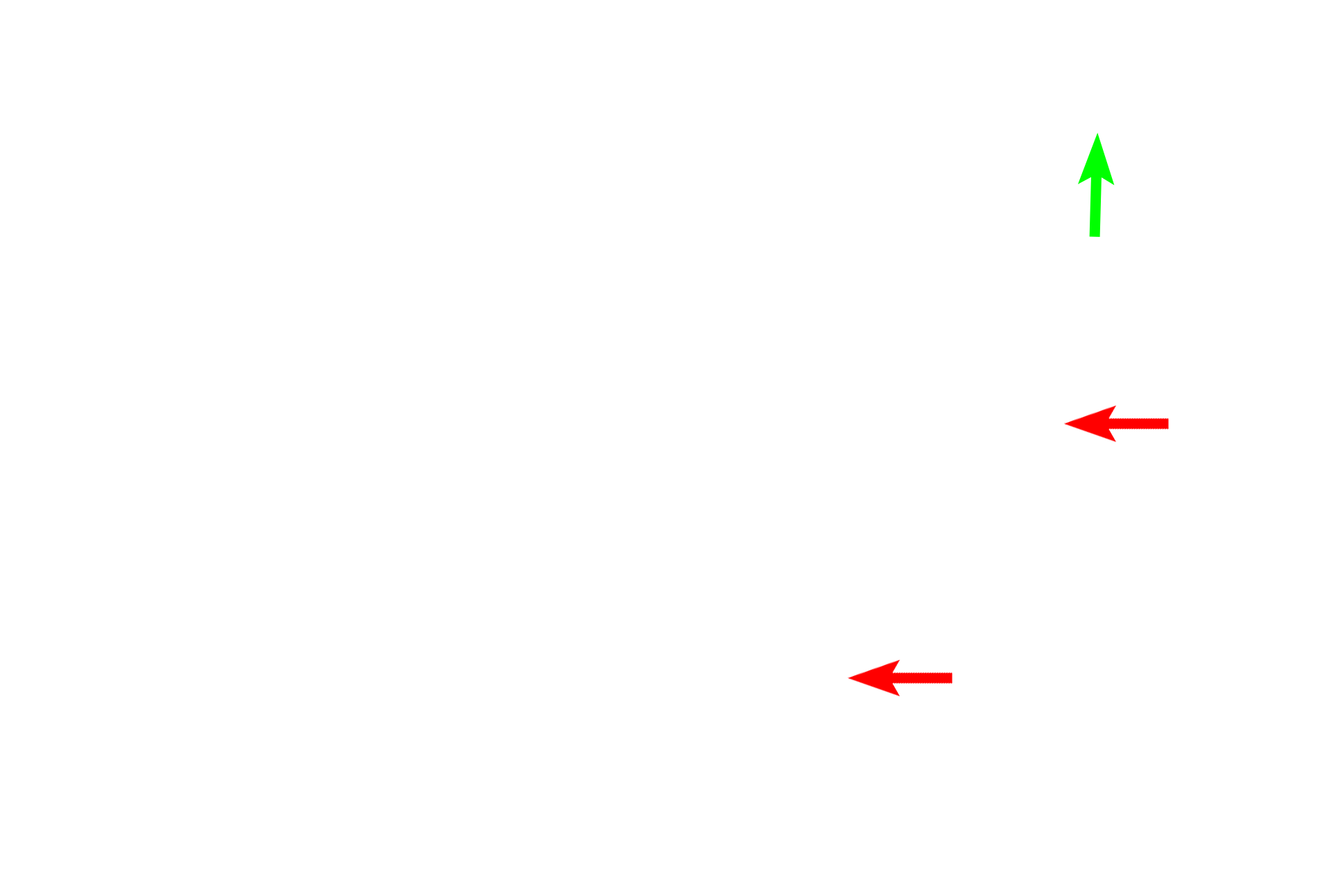 Reticular fibers > <p>Reticular fibers are a type of connective tissue fiber that stains with silver due their unique chemical composition.  Reticular fiber branch, thereby forming a network that provides support for lymphoid tissues.  Reticular fibers are also present around blood vessels in most tissues (green arrow).</p>
