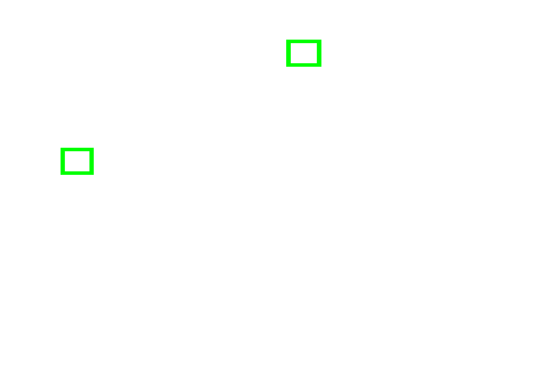 Orientation > <p>This composite image shows a long bone, the femur, together with two light micrographs taken from regions shown by the green boxes. The inset image shows an entire cross section through the bone at the levels of the box in the left image. The higher magnification micrographs show the outer surface of the bone (left) and inner surface (right).</p>
