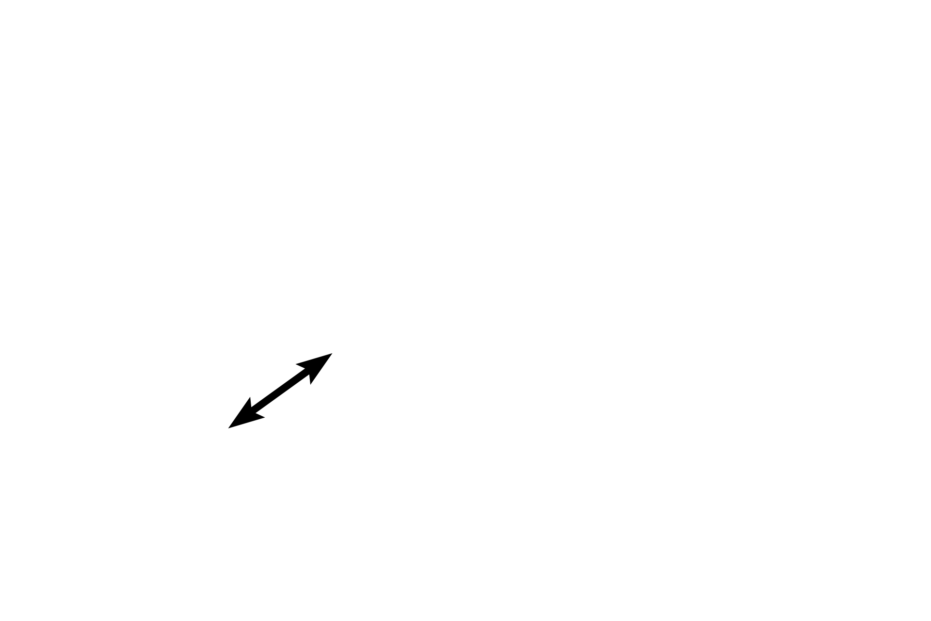 Periosteum > <p>The periosteum surrounding this bone is also not as highly organized as mature bone. The tissue to far left is skeletal muscle.</p>
