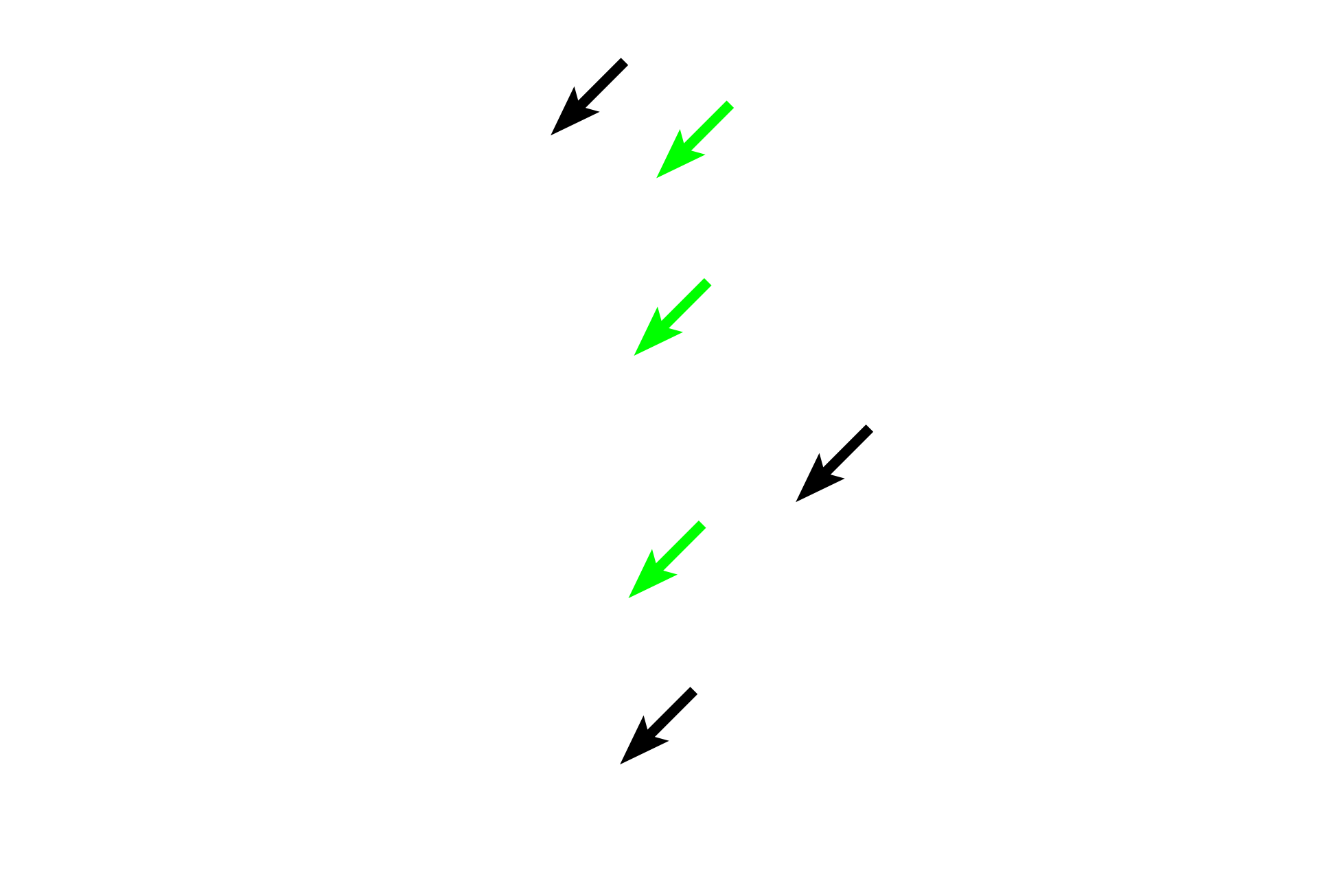 Fibrocartilage > <p>Fibrocartilage is a hybrid between dense connective tissue and hyaline cartilage. Its abundant collagen bundles (black arrows) provide strength. The scattered hyaline cartilage cells (green arrows) produce matrix between the collagen fibers to resist compressional forces.</p>
