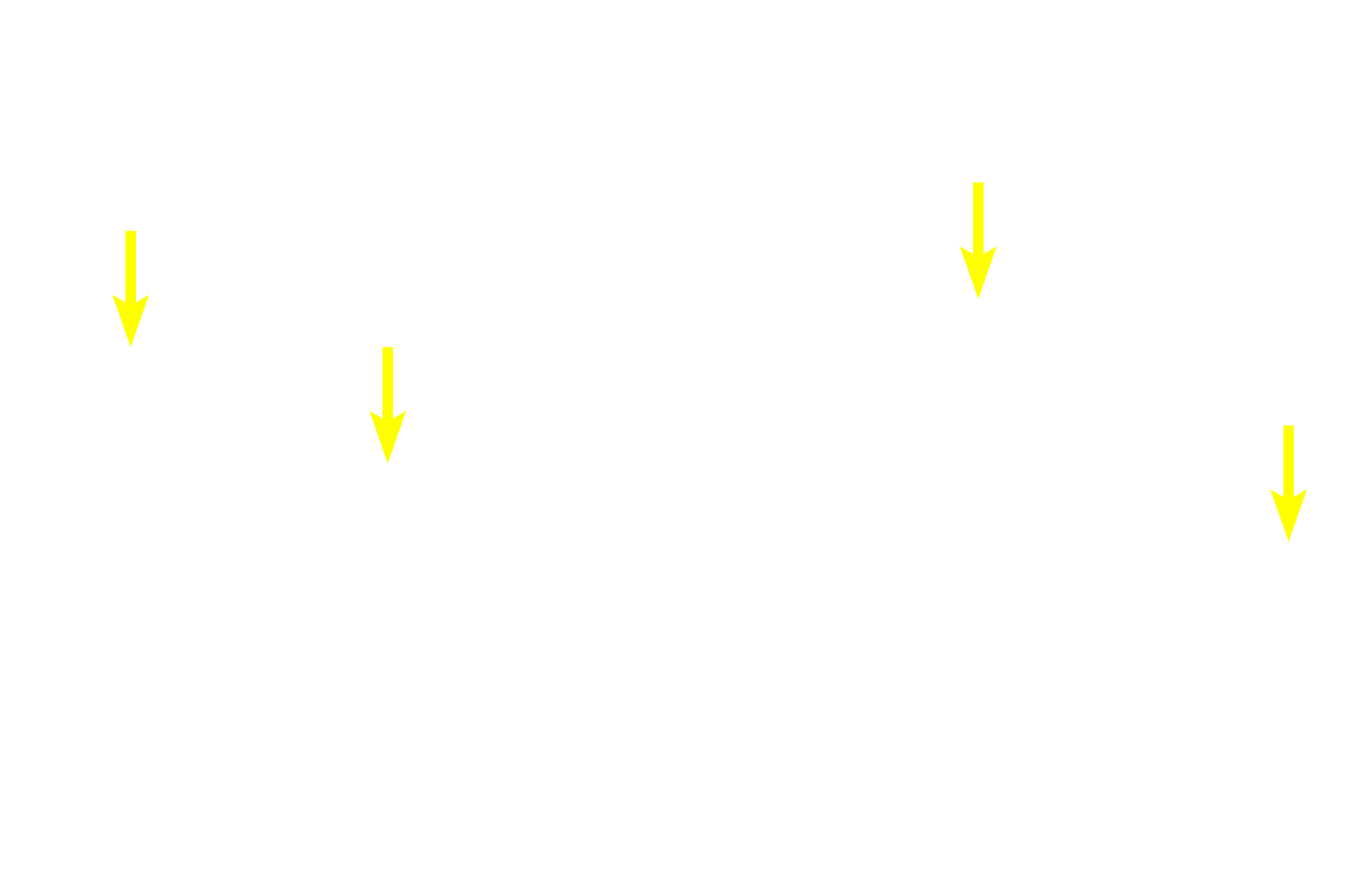 Chondrocytes <p>Isogenous groups and interstitial growth results when chondrocytes divide and produce extracellular matrix. Territorial matrix lies immediately around each isogenous group and is high in glycosaminoglycans. Therefore, this matrix stains more intensely than matrix farther from an isogenous group, the interterritorial matrix. Collagen fibrils are not visible in hyaline cartilage matrix. 1000x</p>
