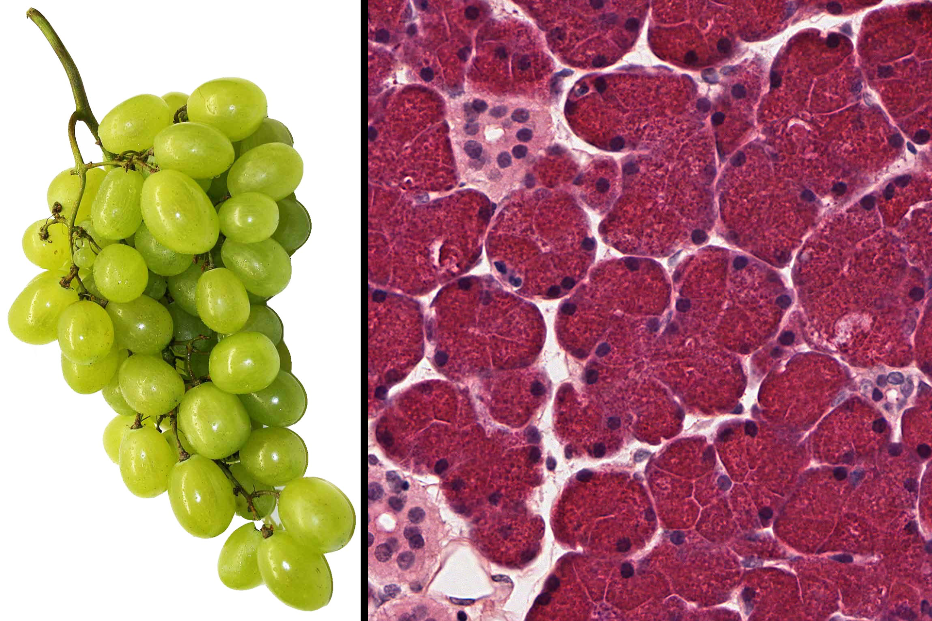 Structure of compound acinar gland > <p>The structure of a compound acinar gland is analogous to the organization of a bunch of grapes.  Each bunch represents a lobule with individual grapes corresponding to acini.  Smaller stems connecting to the grapes denote intralobular ducts with the larger stems representing the interlobular duct.  It’s helpful to keep this similarity in mind when interpreting tissue sections of compound glands.</p>
