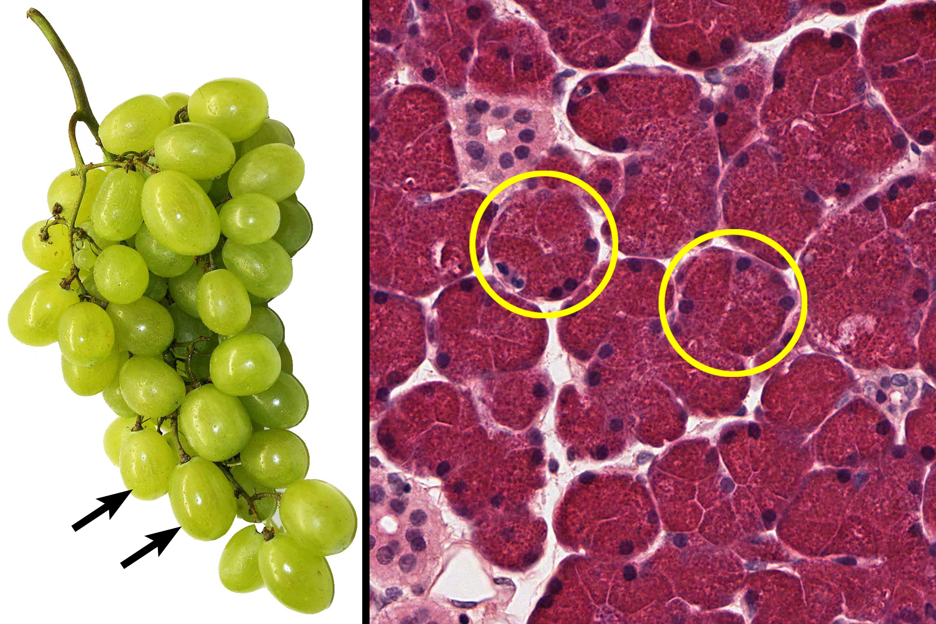  - Acini <p>The structure of a compound acinar gland is analogous to the organization of a bunch of grapes.  Each bunch represents a lobule with individual grapes corresponding to acini.  Smaller stems connecting to the grapes denote intralobular ducts with the larger stems representing the interlobular duct.  It’s helpful to keep this similarity in mind when interpreting tissue sections of compound glands.</p>
