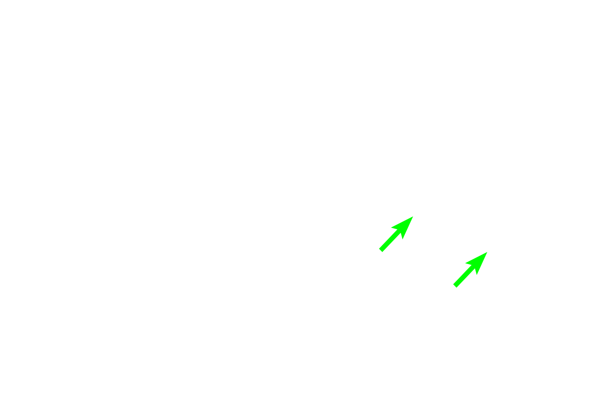  - Nuclei <p>Tubules, as the name indicates, are linear secretory units lined by cuboidal to columnar cells.  A number of tubules in longitudinal and cross section are visible in the image.  Most tubules secrete mucus and the apical region appears frothy or clear because the mucus is easily extracted during tissue processing.  The nuclei are basally located and compressed by the mass of mucus above them.  Tubules have a wide lumen to accommodate the thick, mucus secretion.</p>
